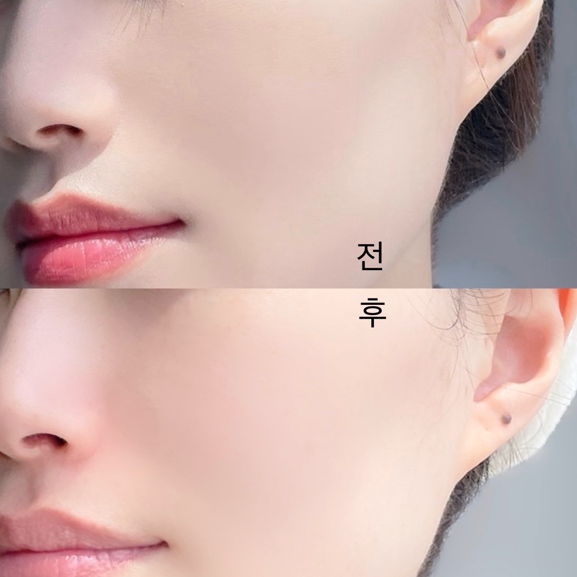 피드이미지정보-4