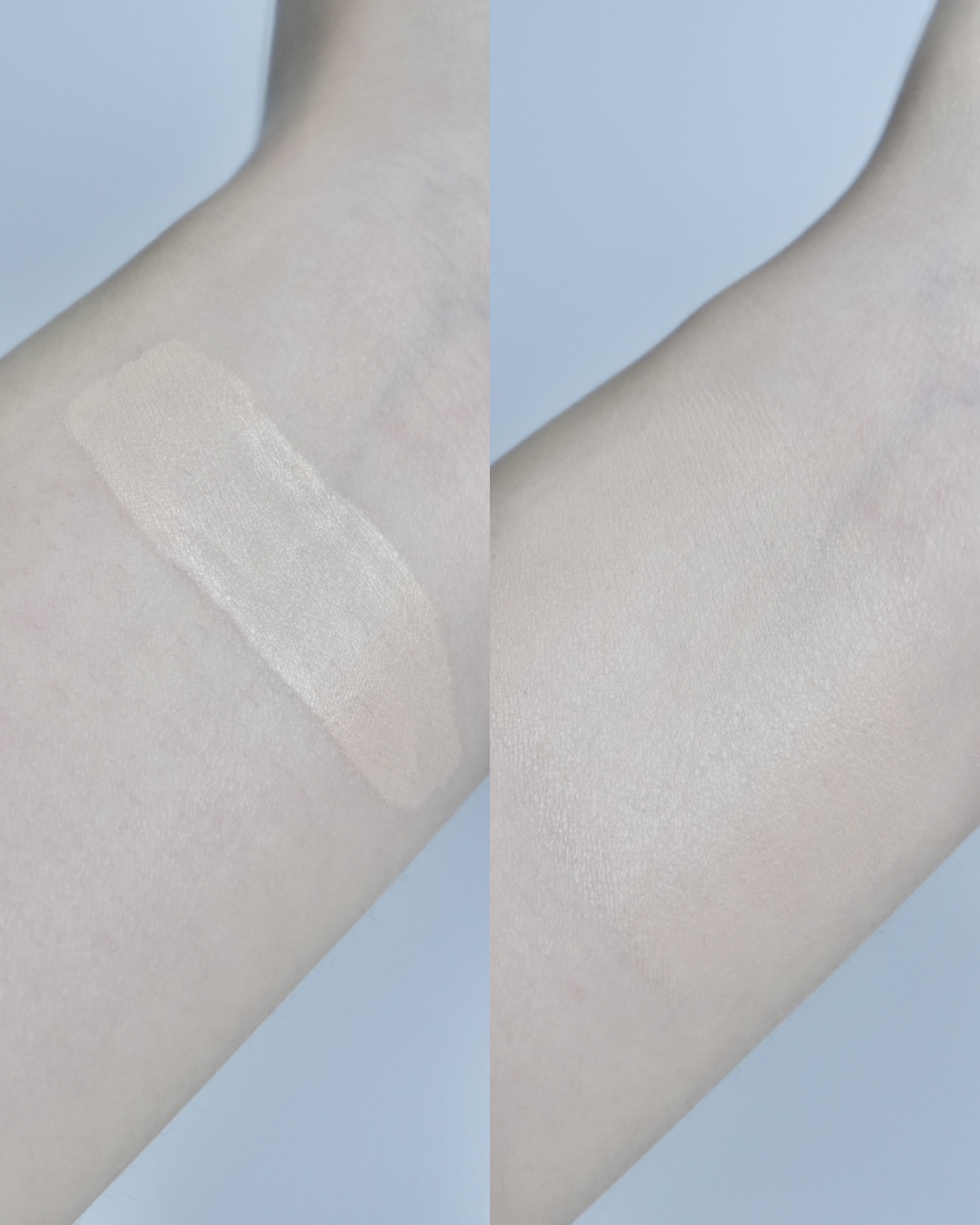 피드이미지정보-5