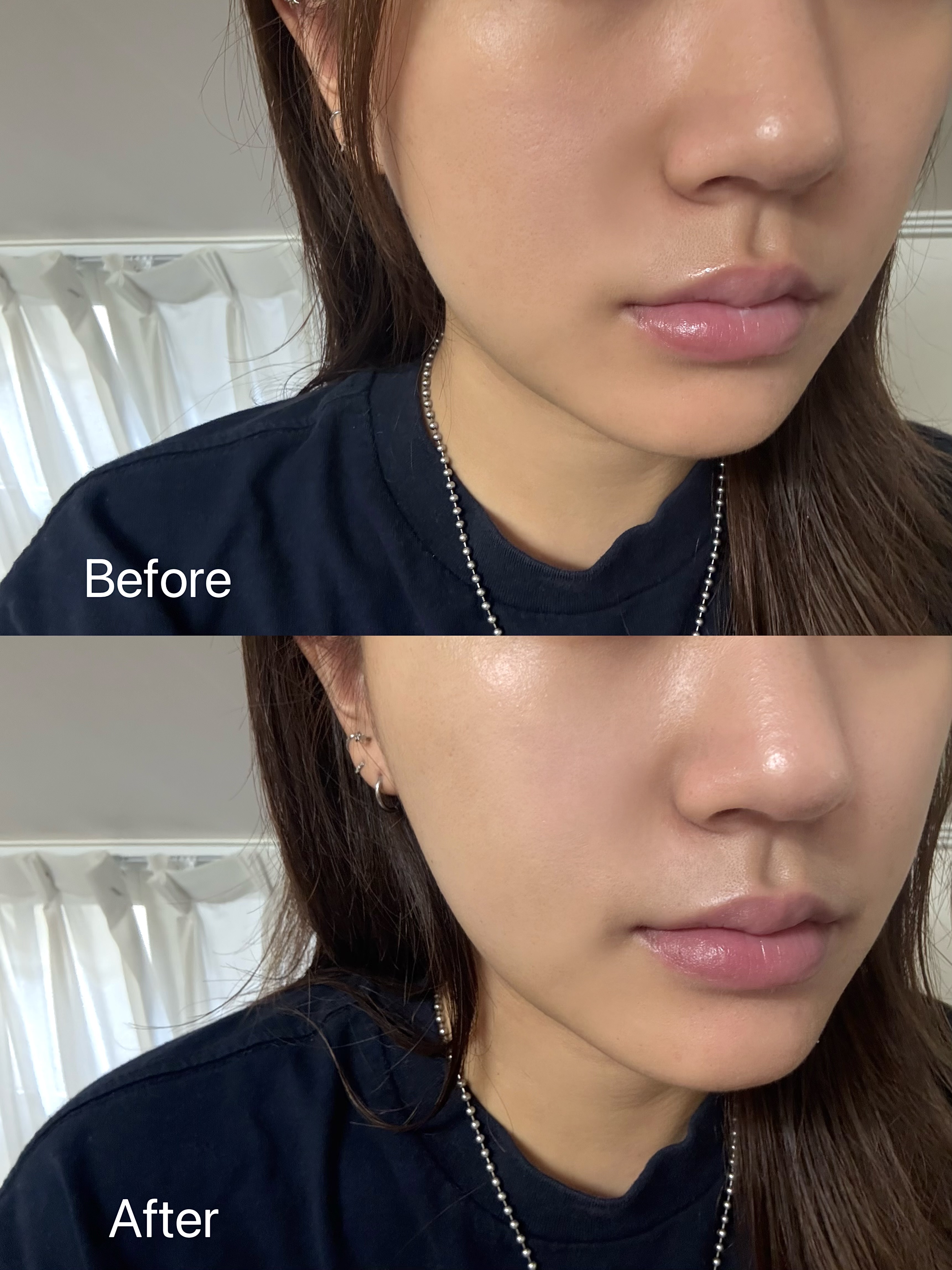 피드이미지정보-0