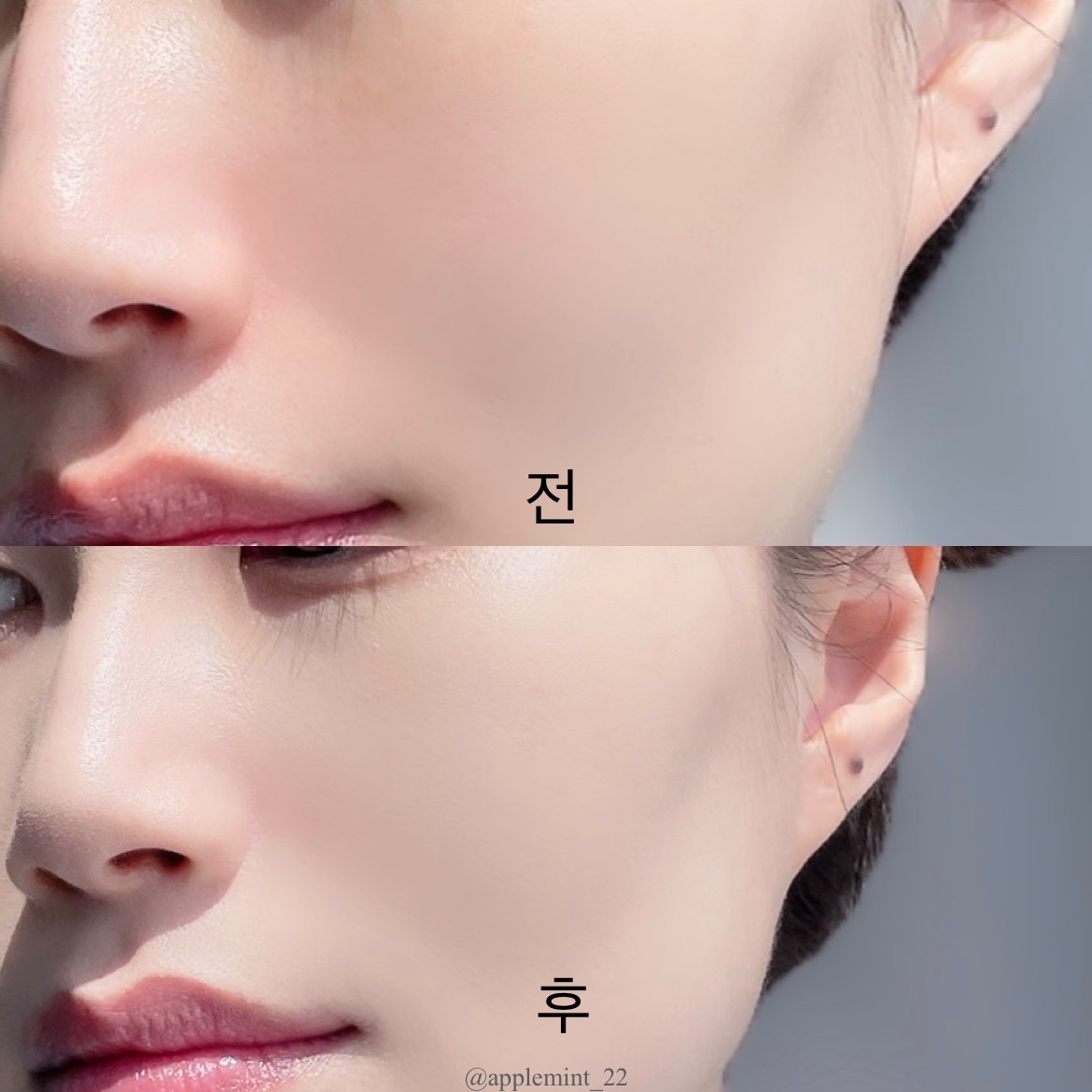 피드이미지정보-7