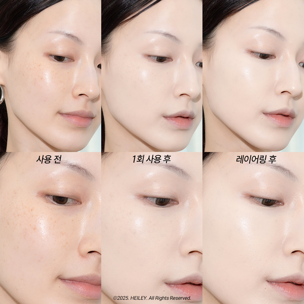 피드이미지정보-6