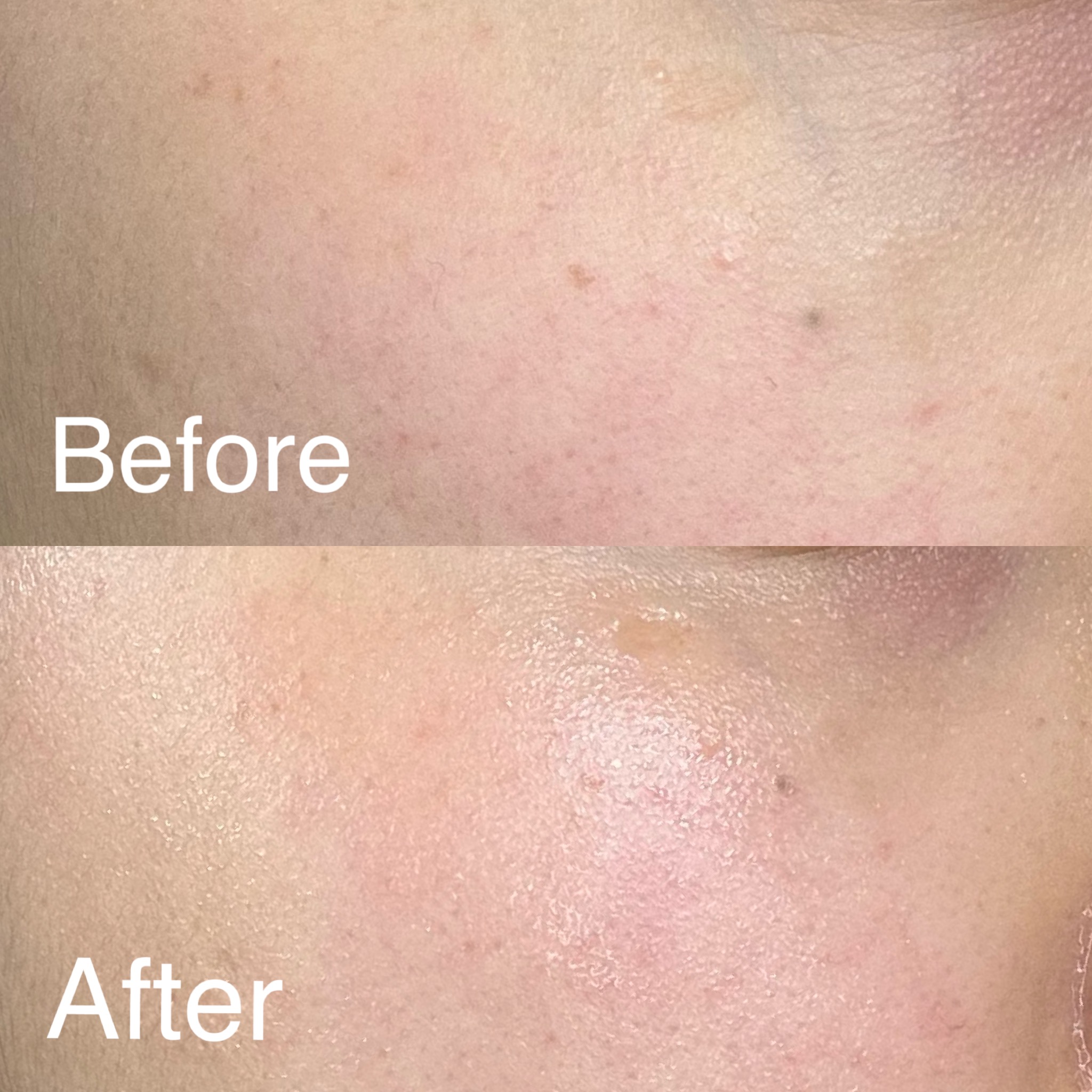 피드이미지정보-5