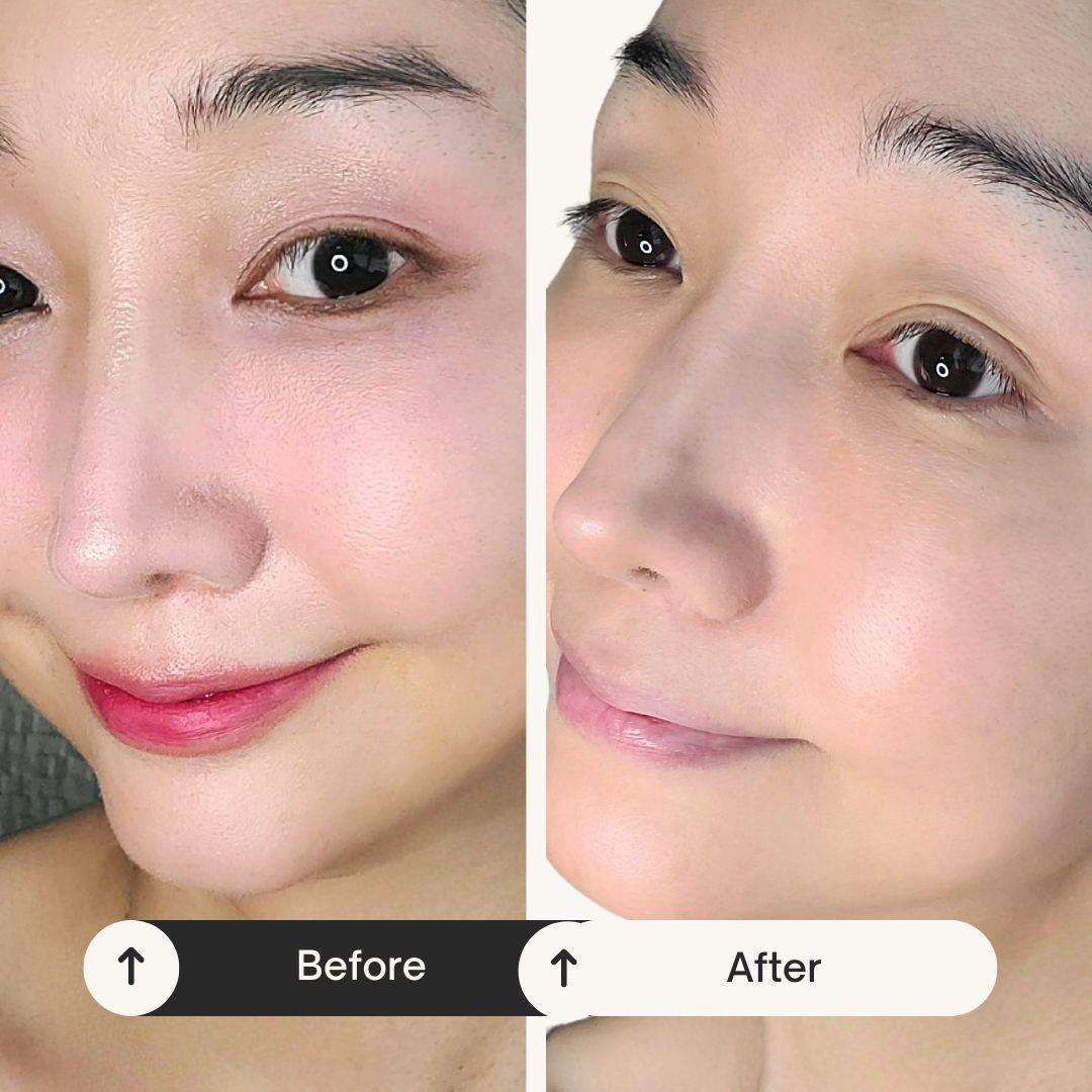 피드이미지정보-2