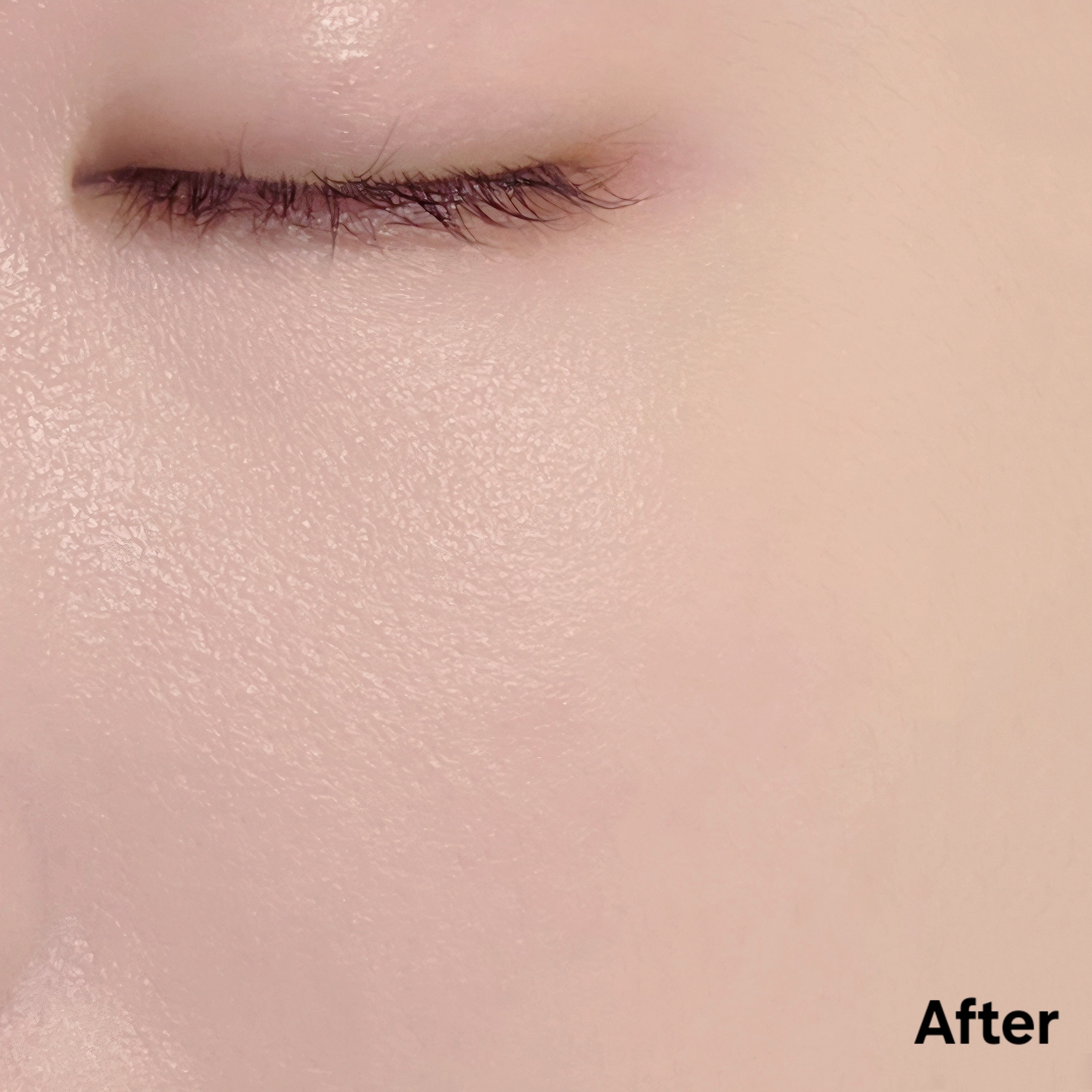 피드이미지정보-7