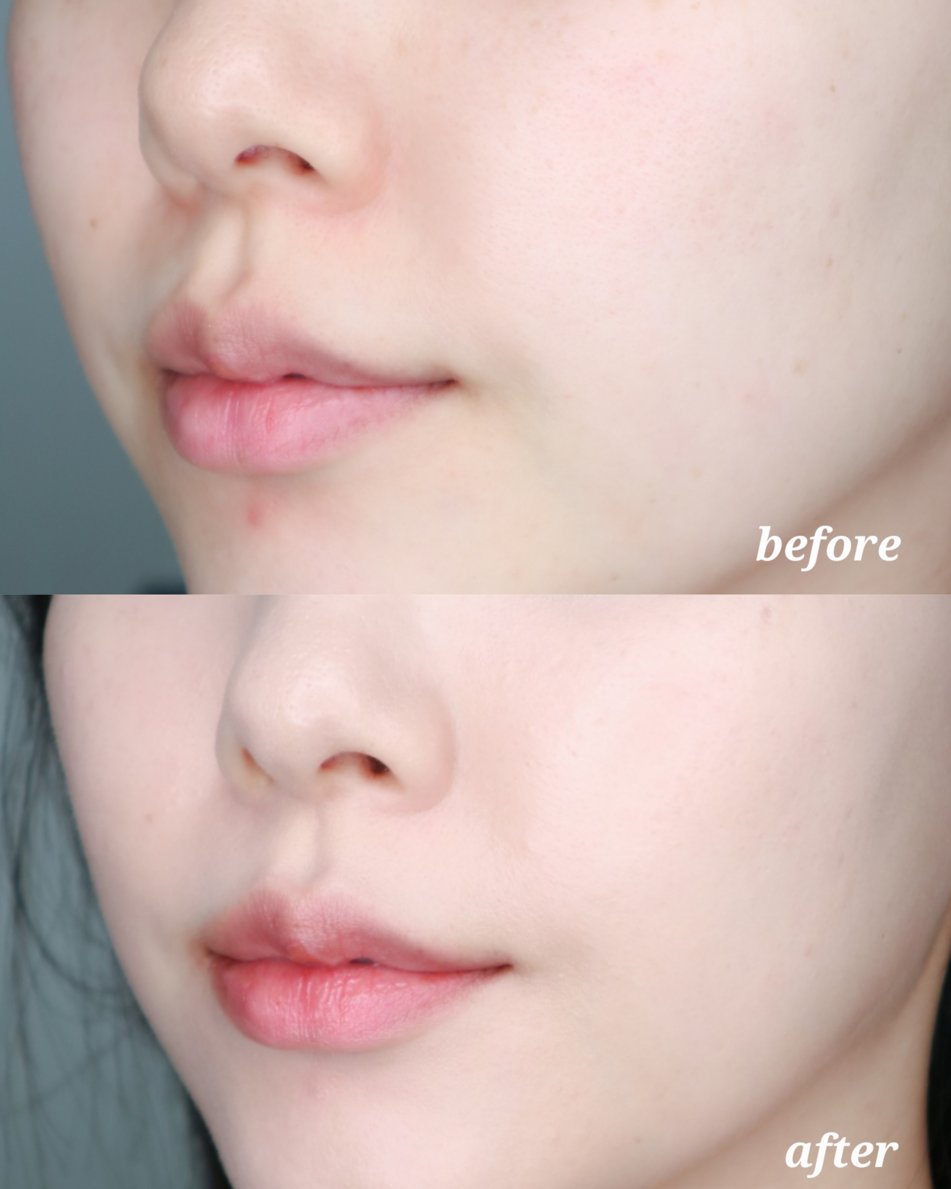 피드이미지정보-2