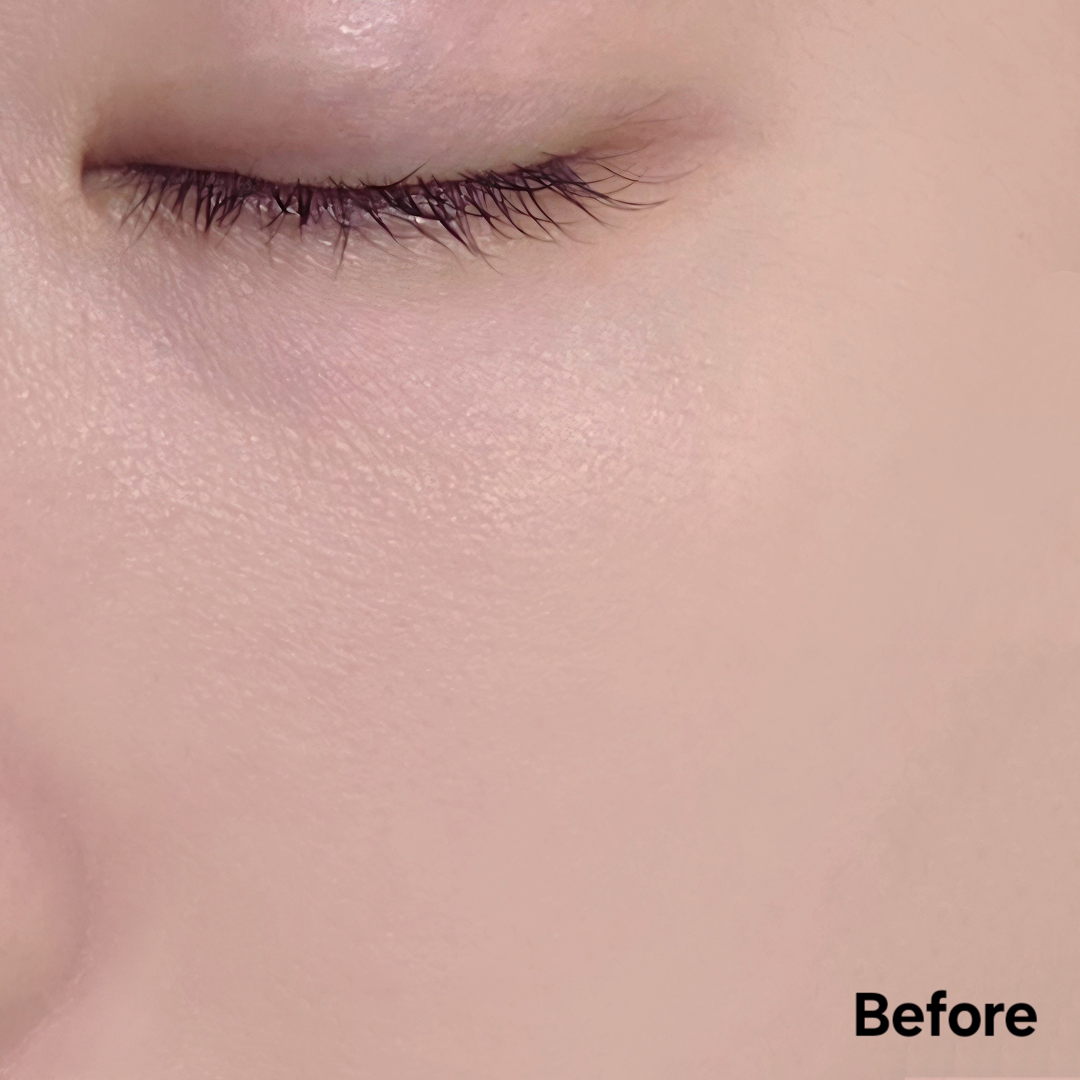 피드이미지정보-6