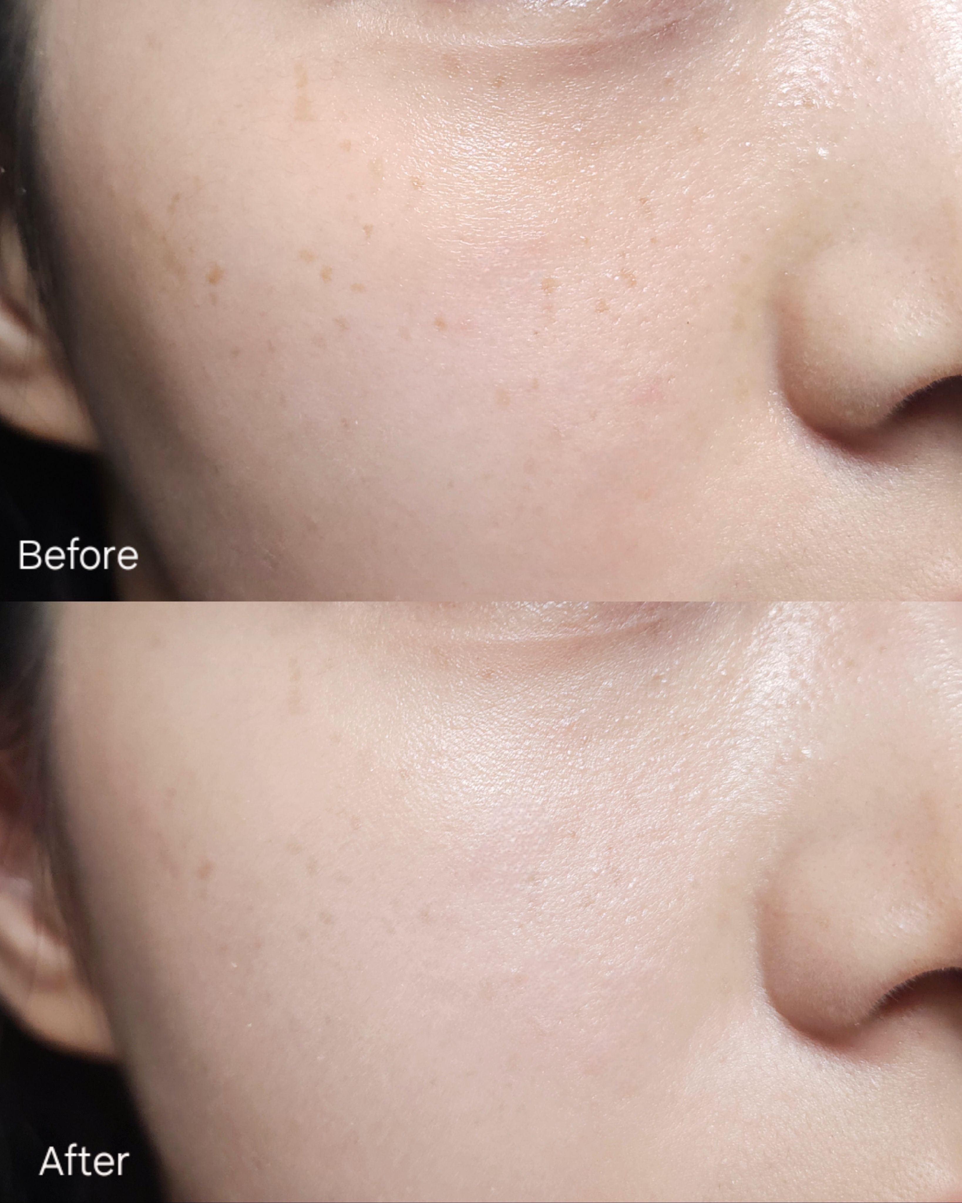 피드이미지정보-2