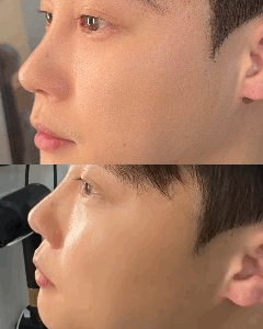 피드이미지정보-0