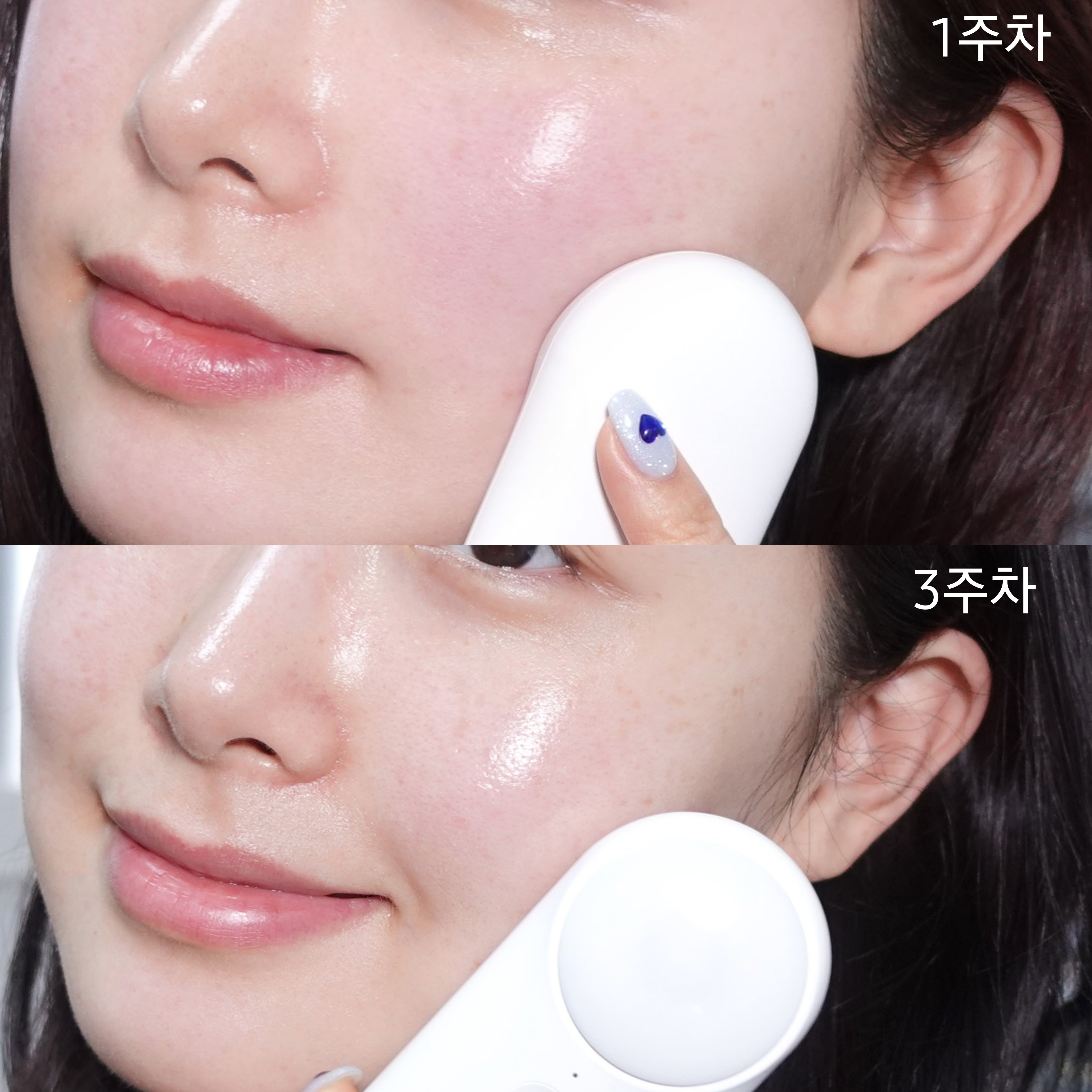 피드이미지정보-0