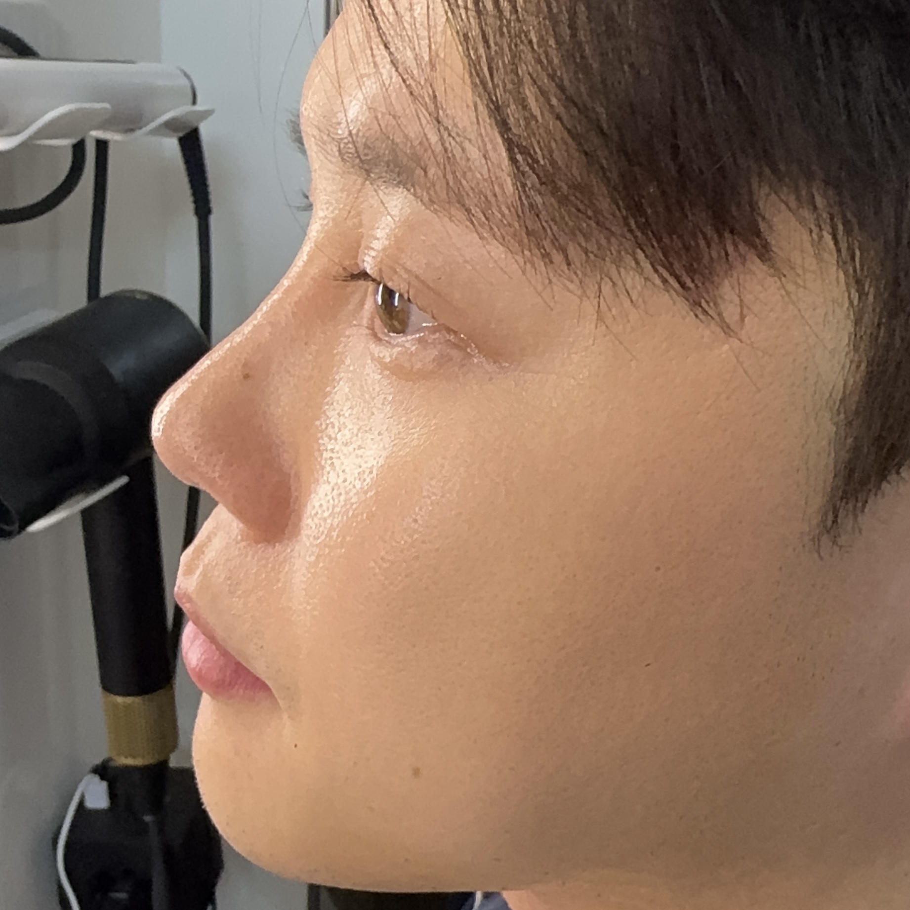 피드이미지정보-3