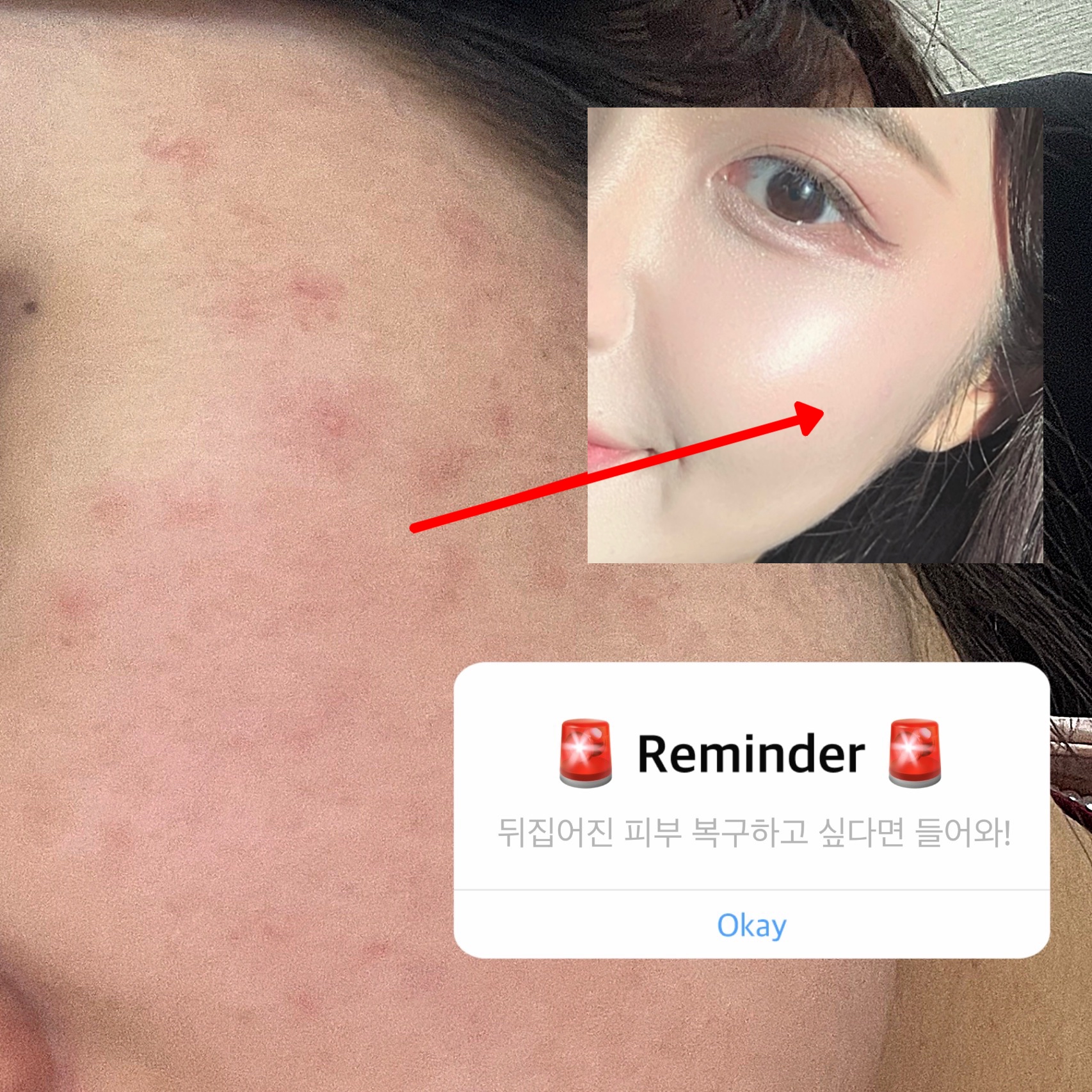 피드이미지정보-0