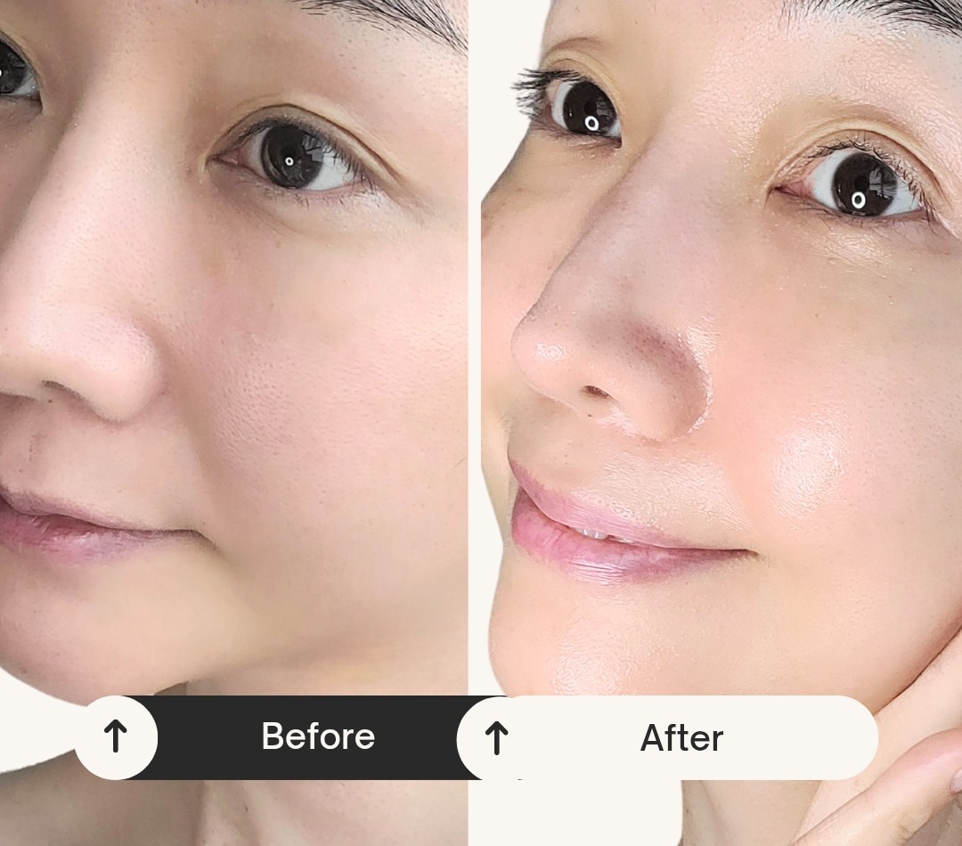 피드이미지정보-5