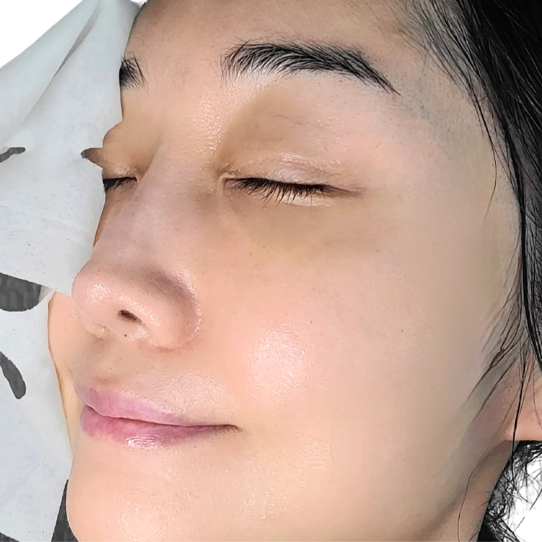 피드이미지정보-4