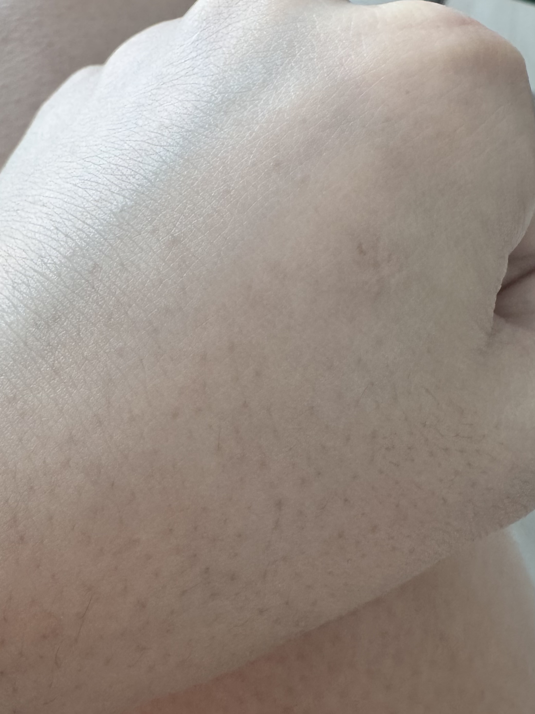 피드이미지정보-5