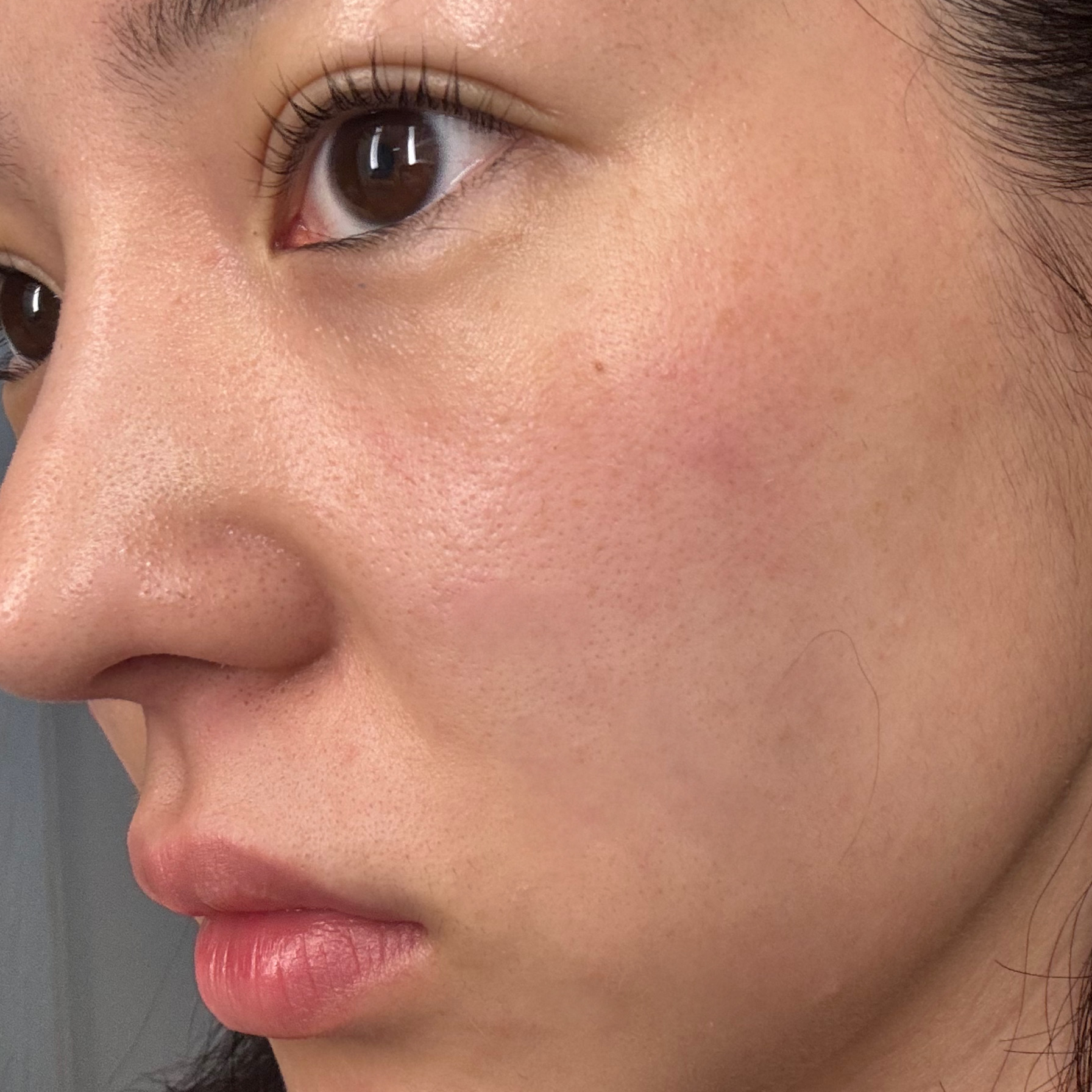 피드이미지정보-2