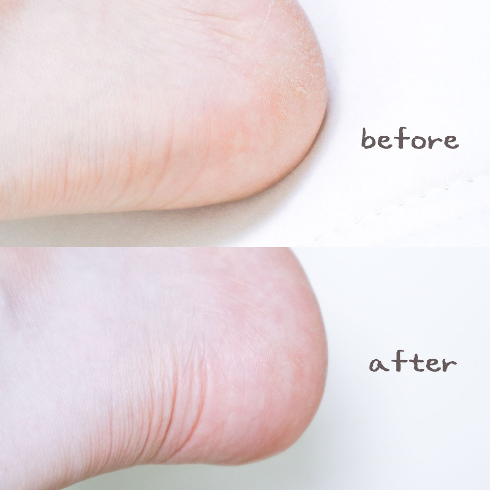 피드이미지정보-2