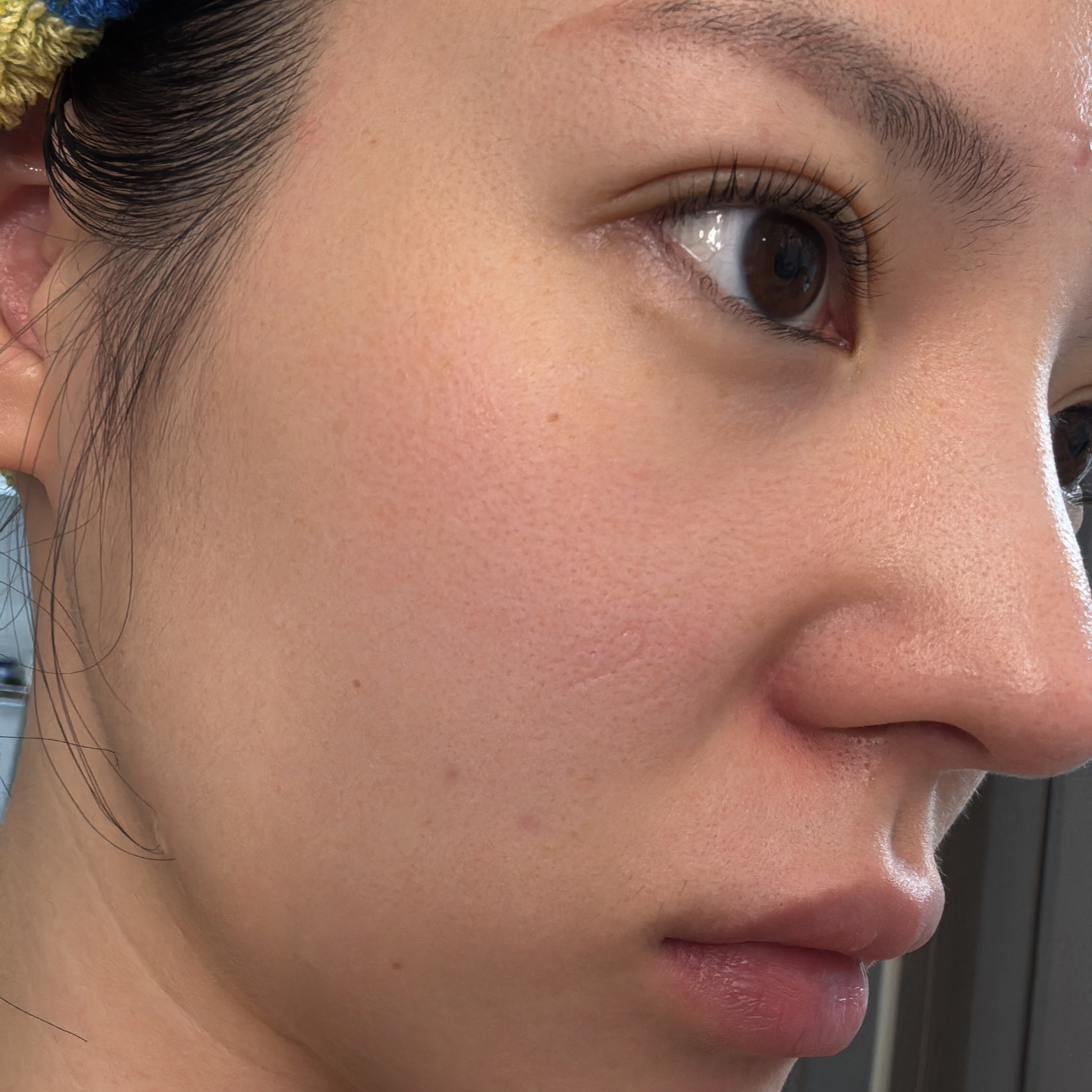 피드이미지정보-2