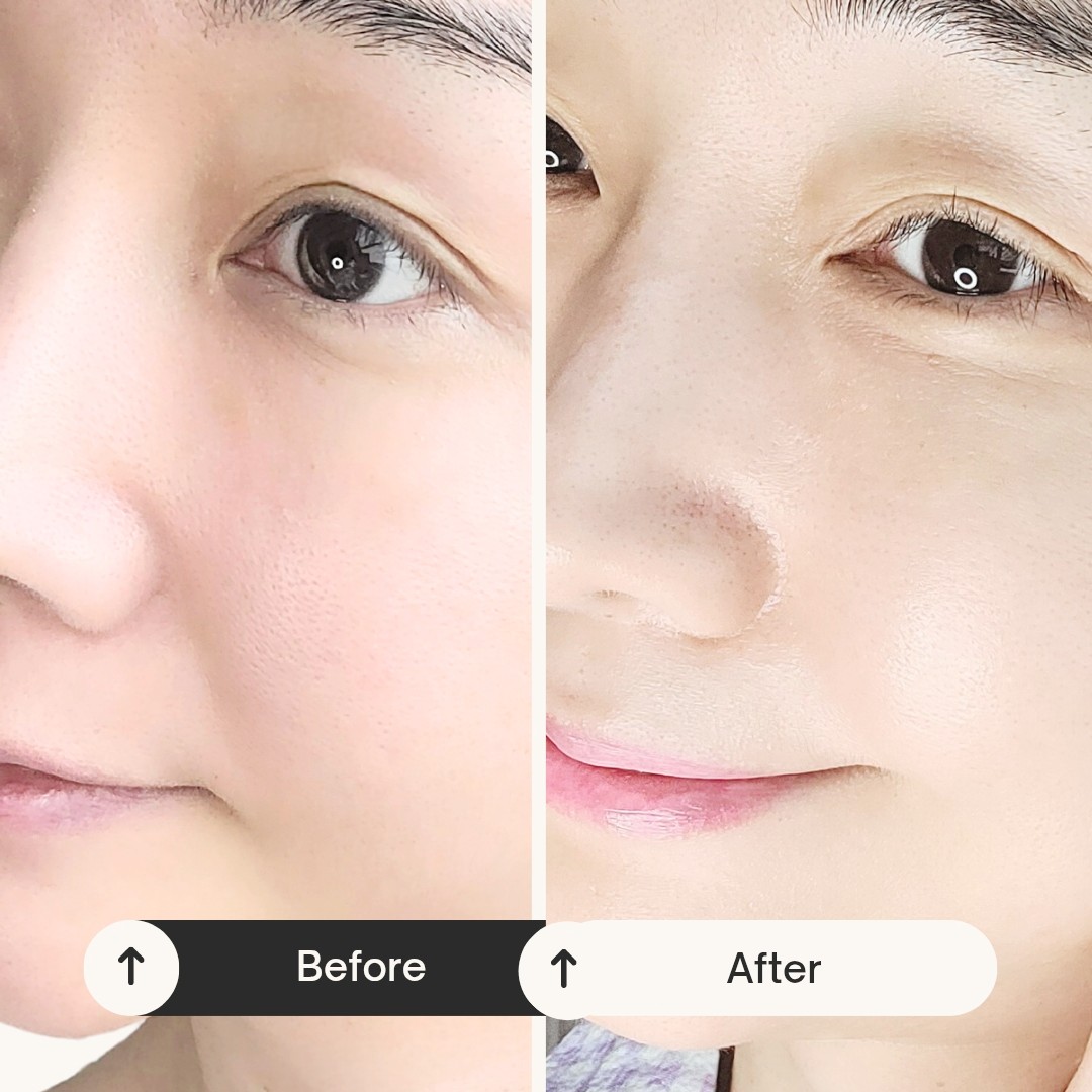 피드이미지정보-6