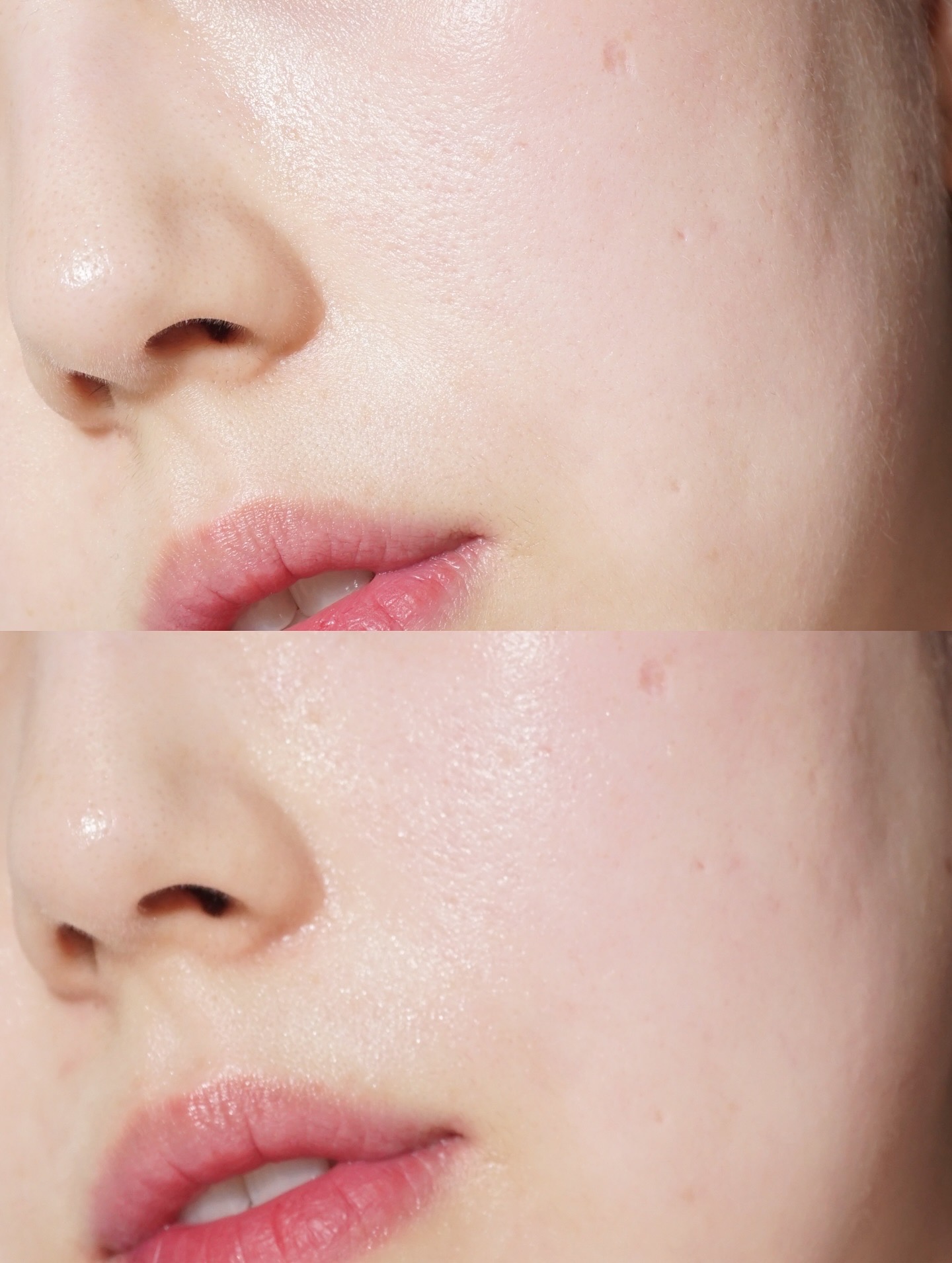 피드이미지정보-4