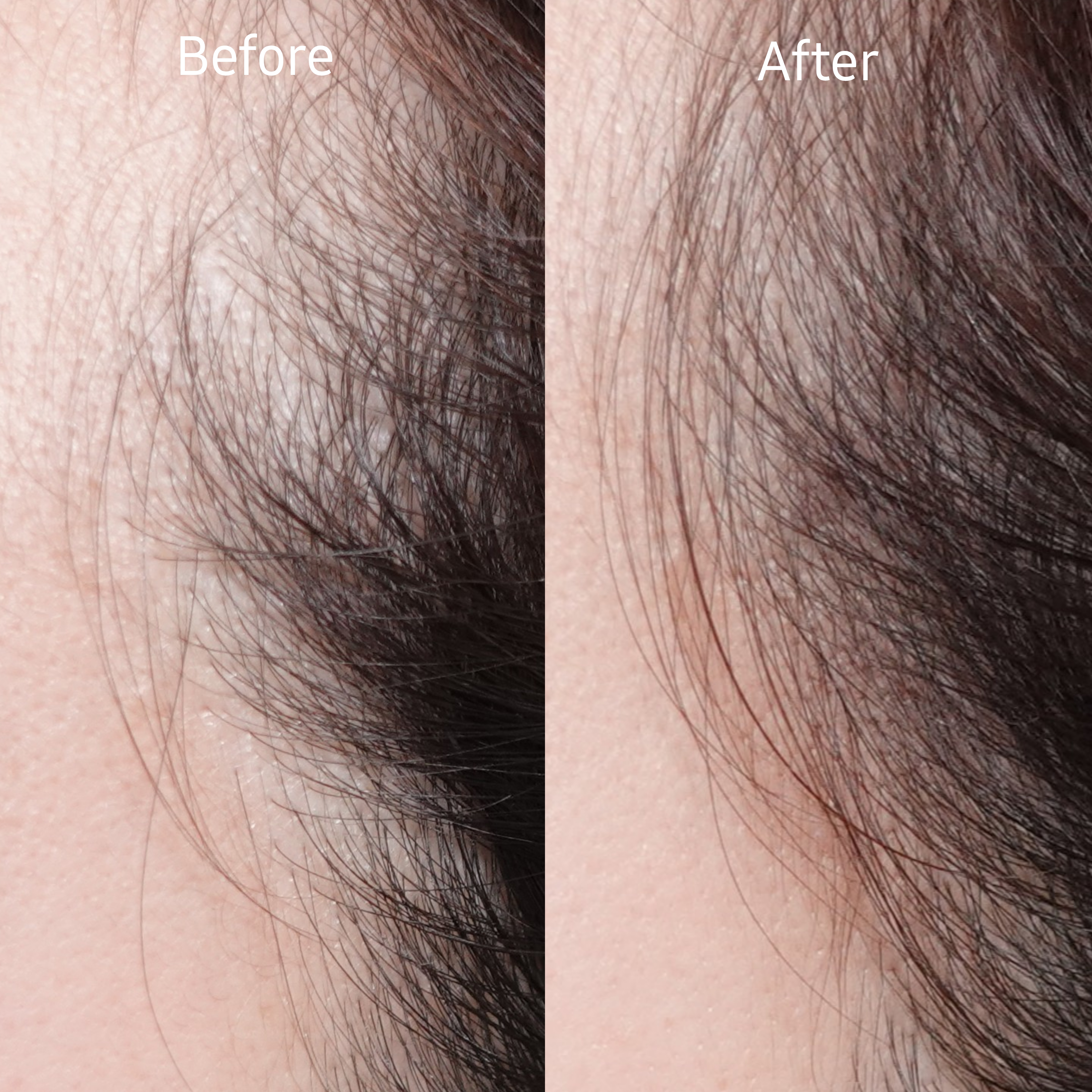 피드이미지정보-6