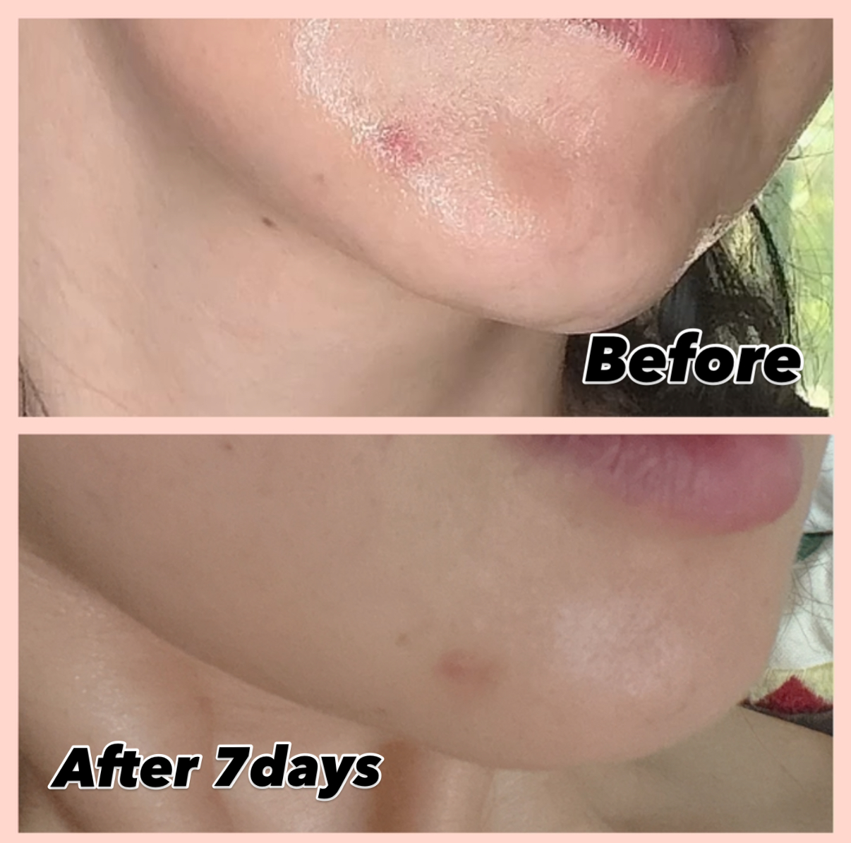 피드이미지정보-3