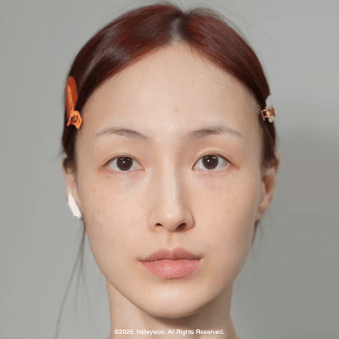 피드이미지정보-5