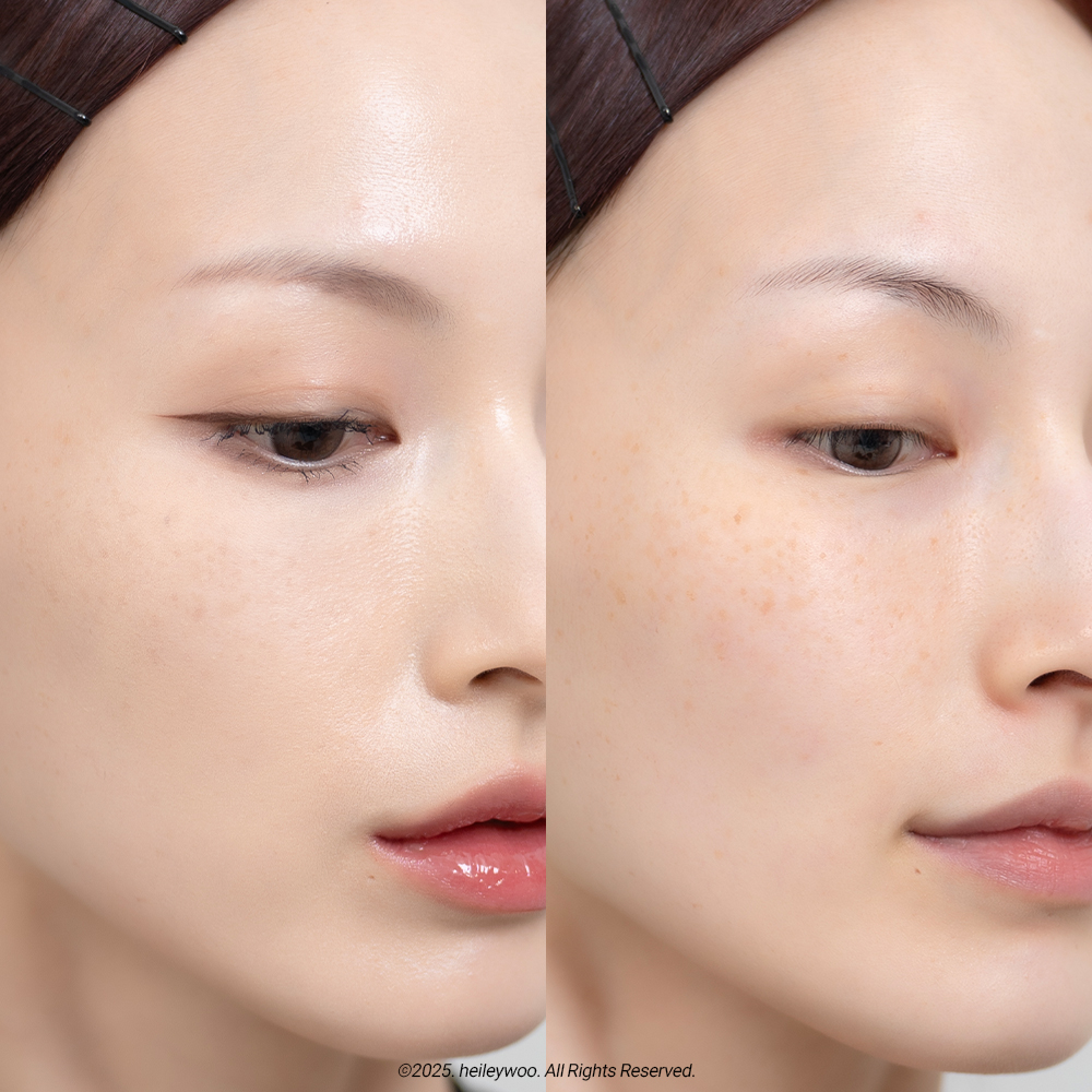 피드이미지정보-7