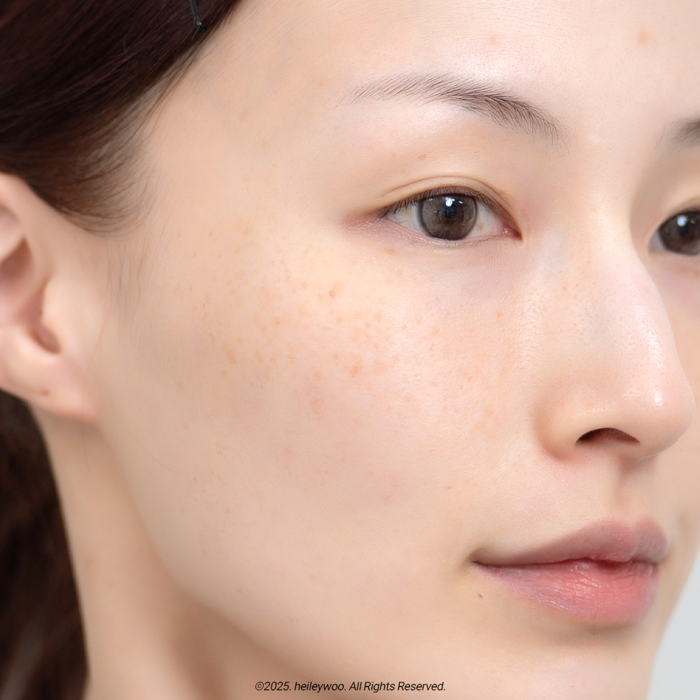 피드이미지정보-6