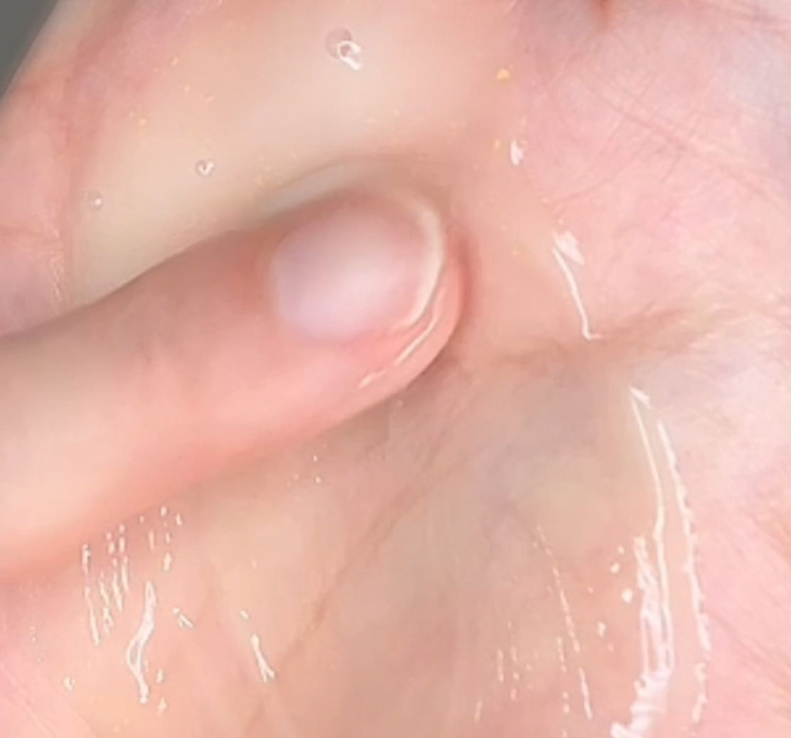 피드이미지정보-4