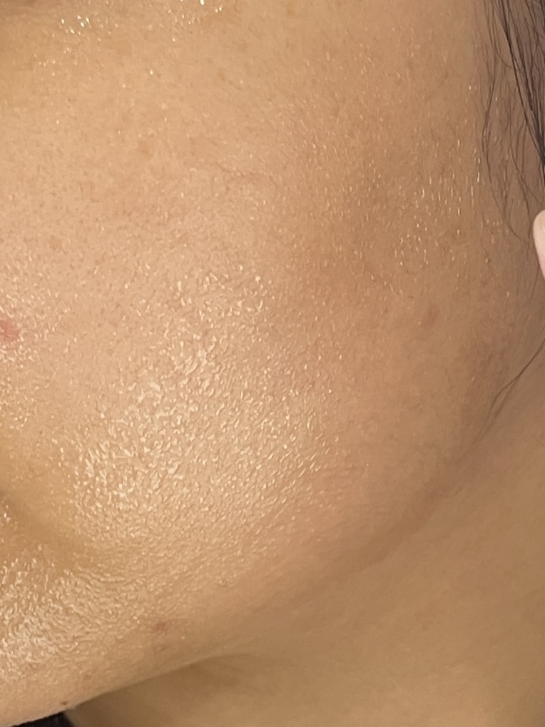 피드이미지정보-1