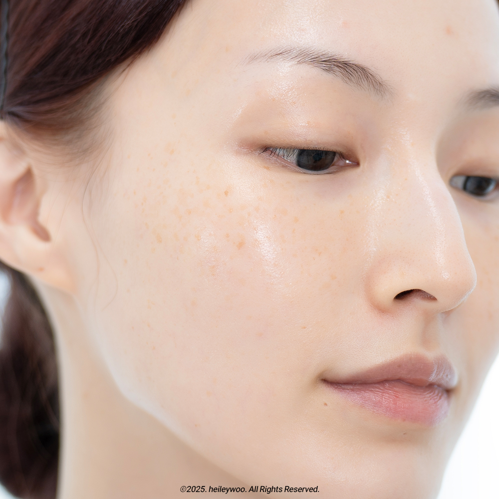 피드이미지정보-8