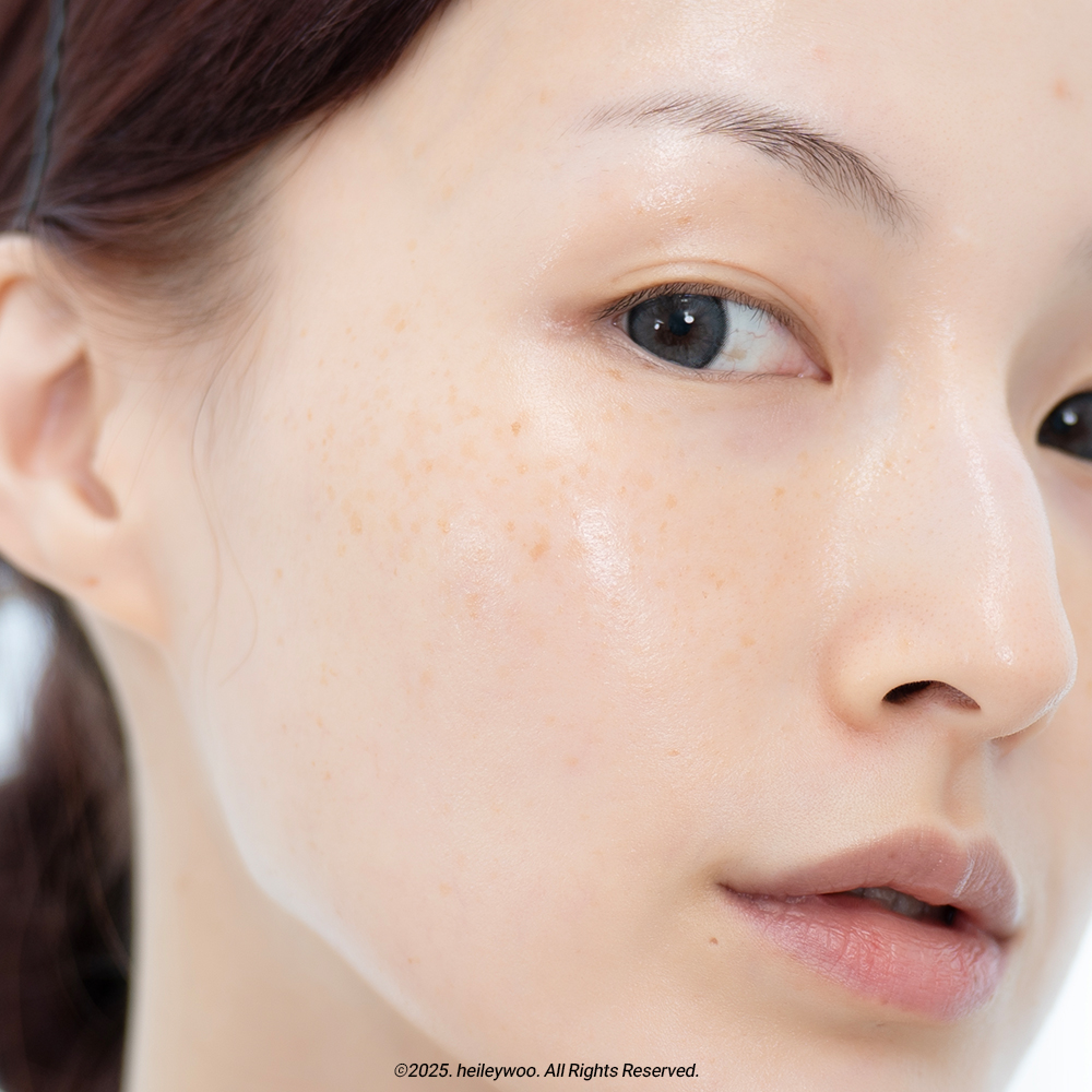 피드이미지정보-3