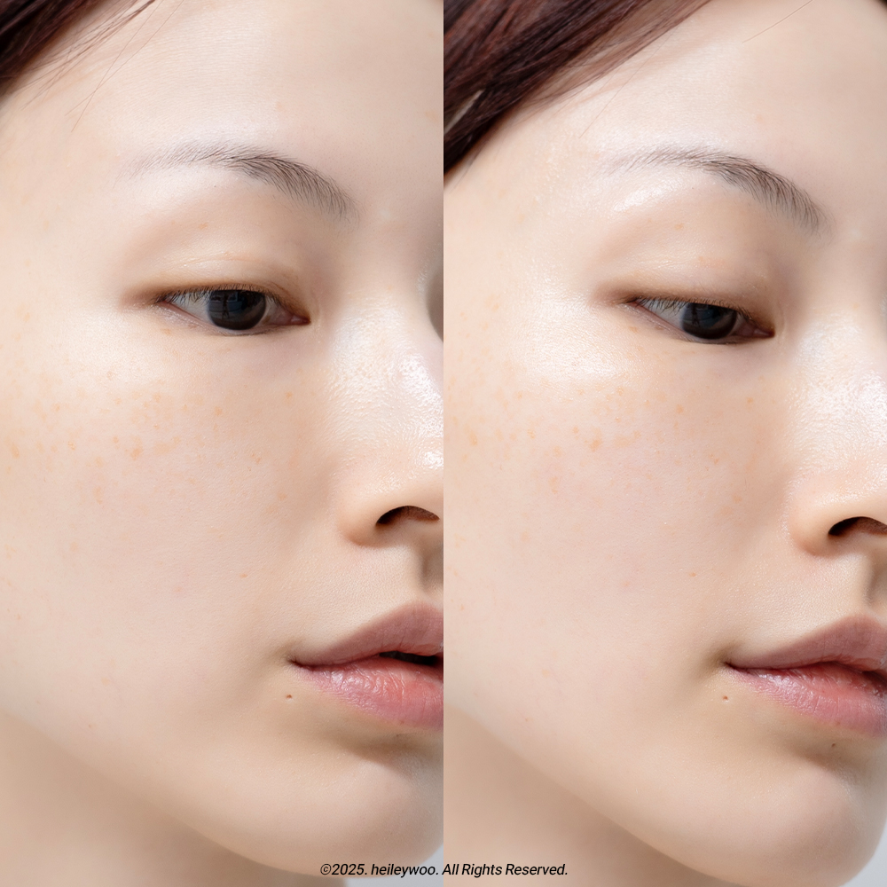 피드이미지정보-5