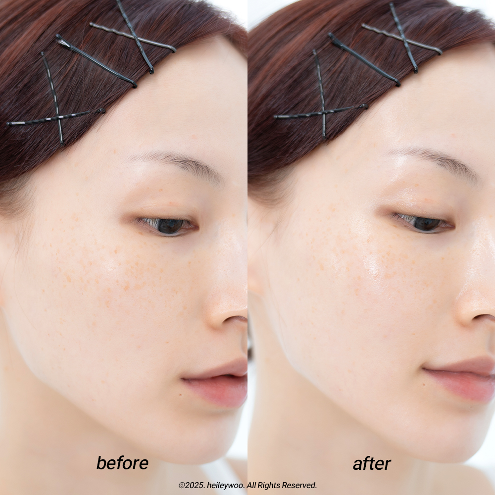 피드이미지정보-4