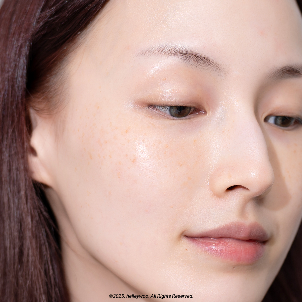 피드이미지정보-1