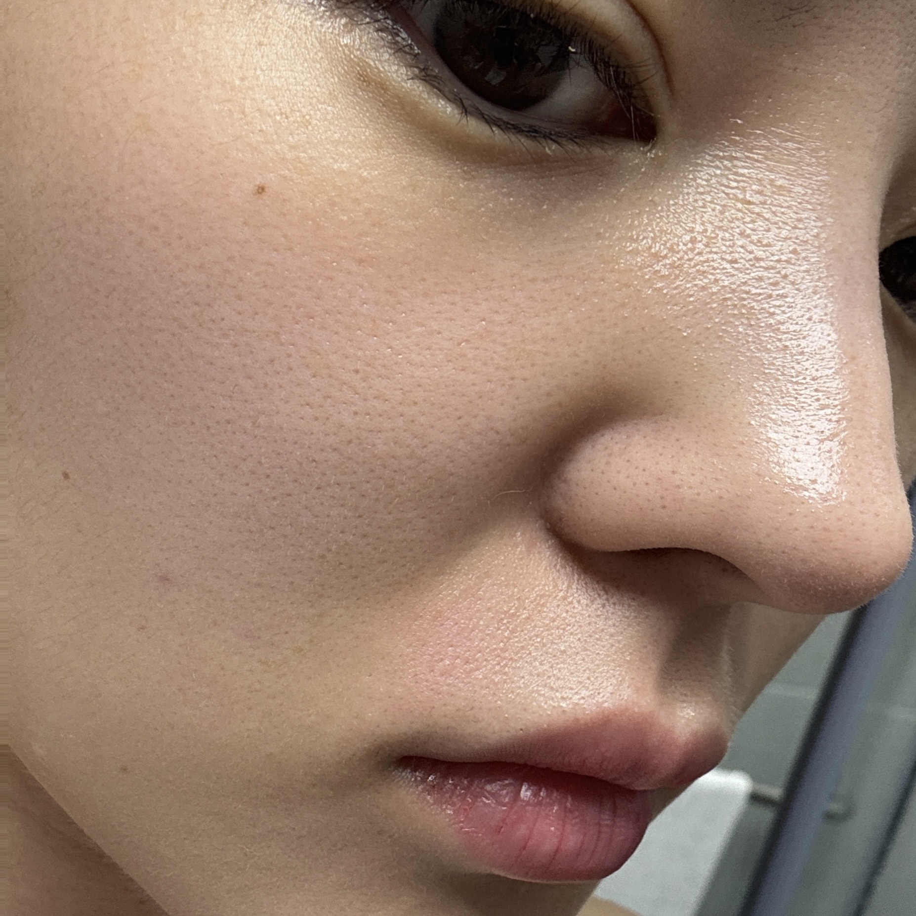 피드이미지정보-1