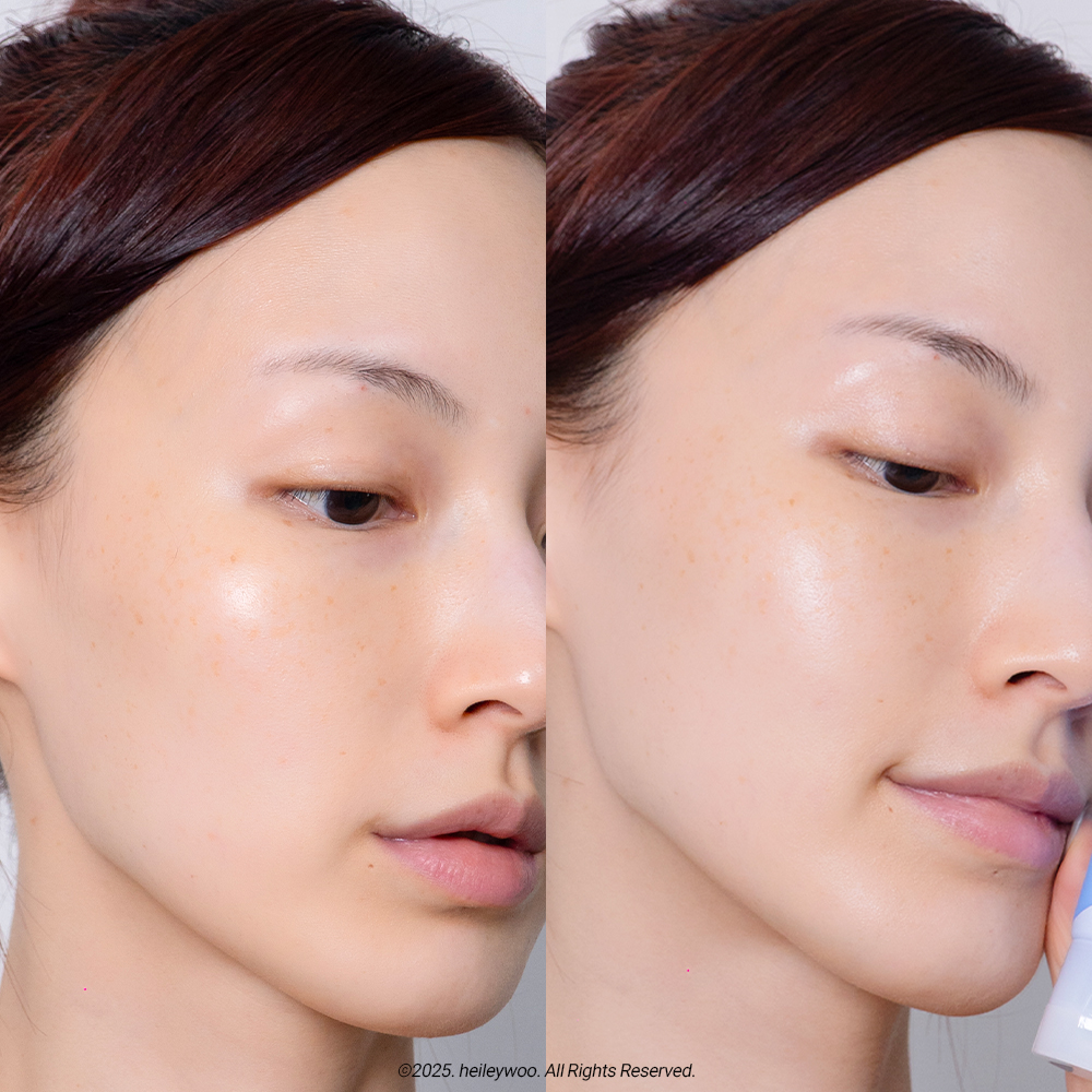 피드이미지정보-2