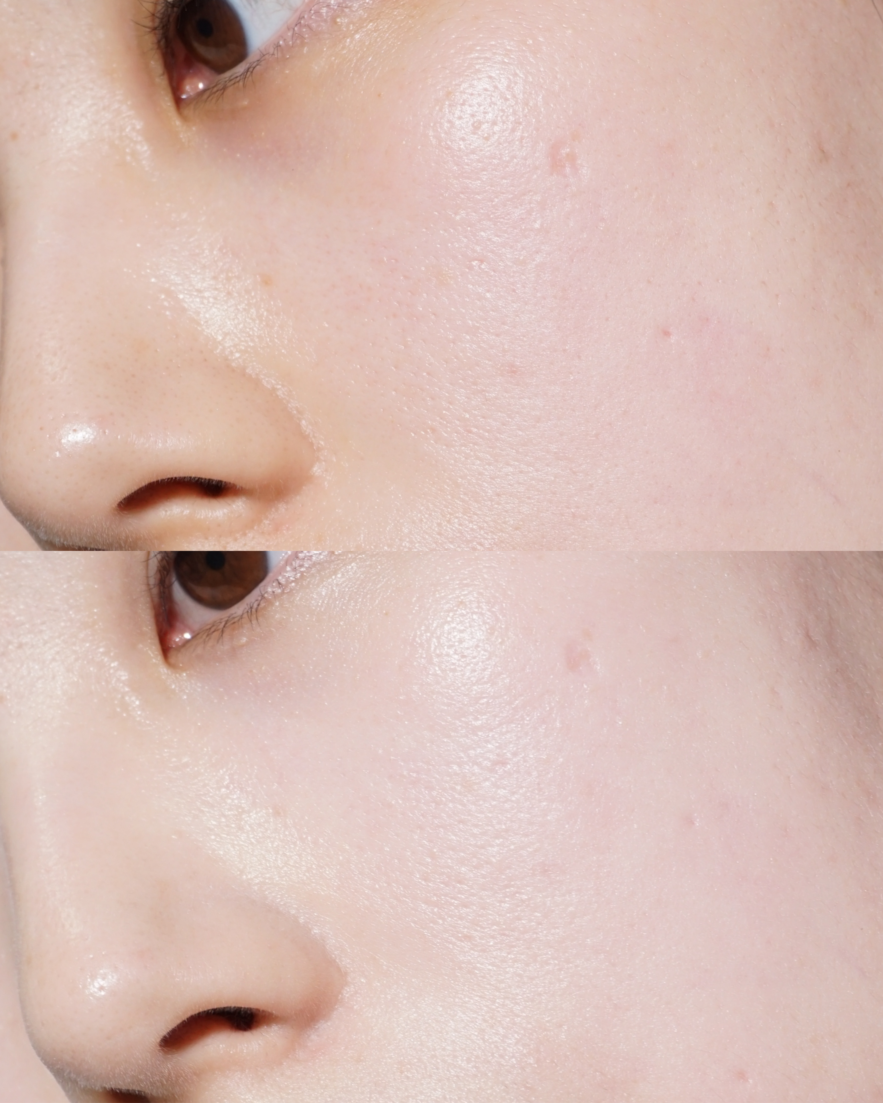 피드이미지정보-5