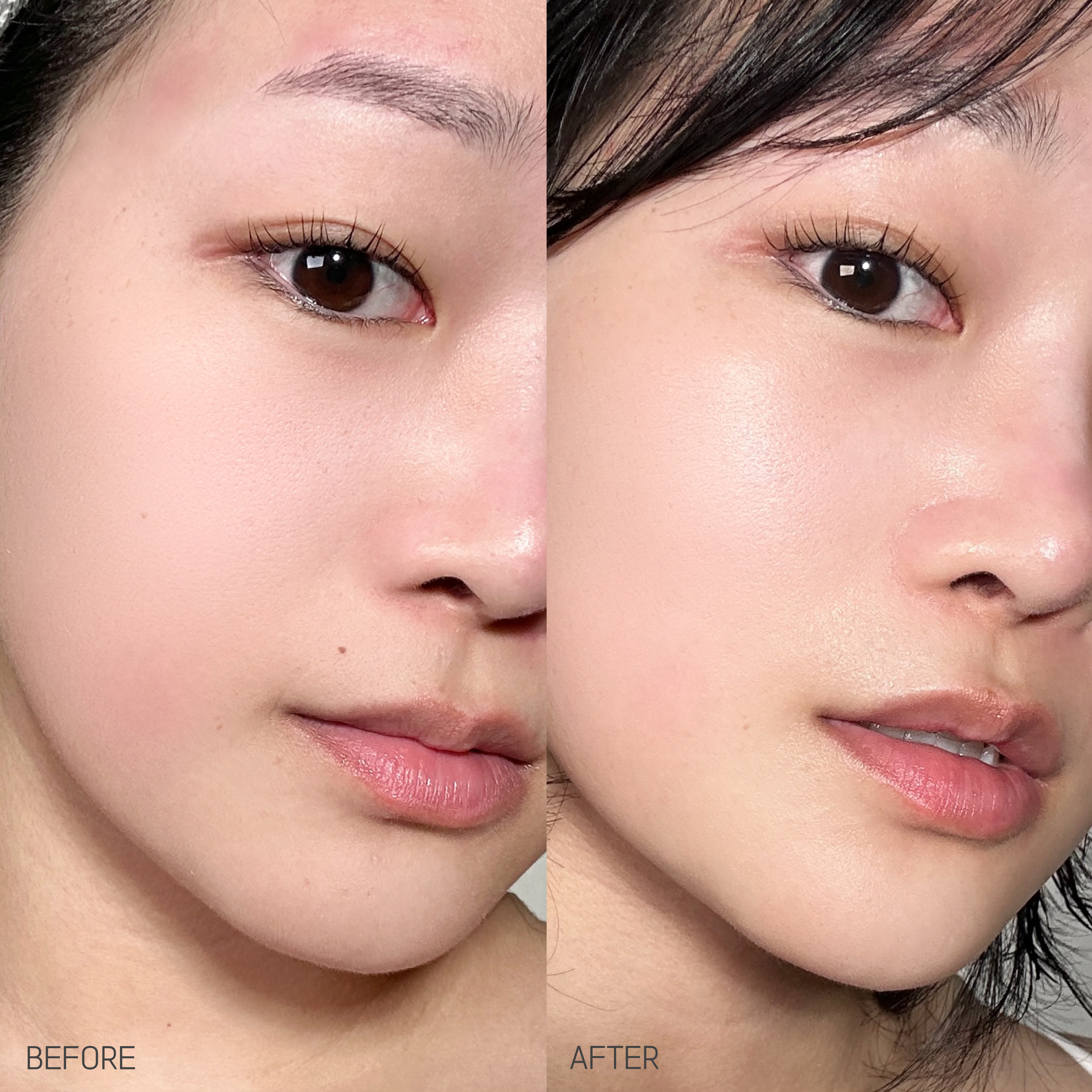 피드이미지정보-1