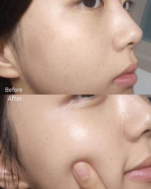 피드이미지정보-3