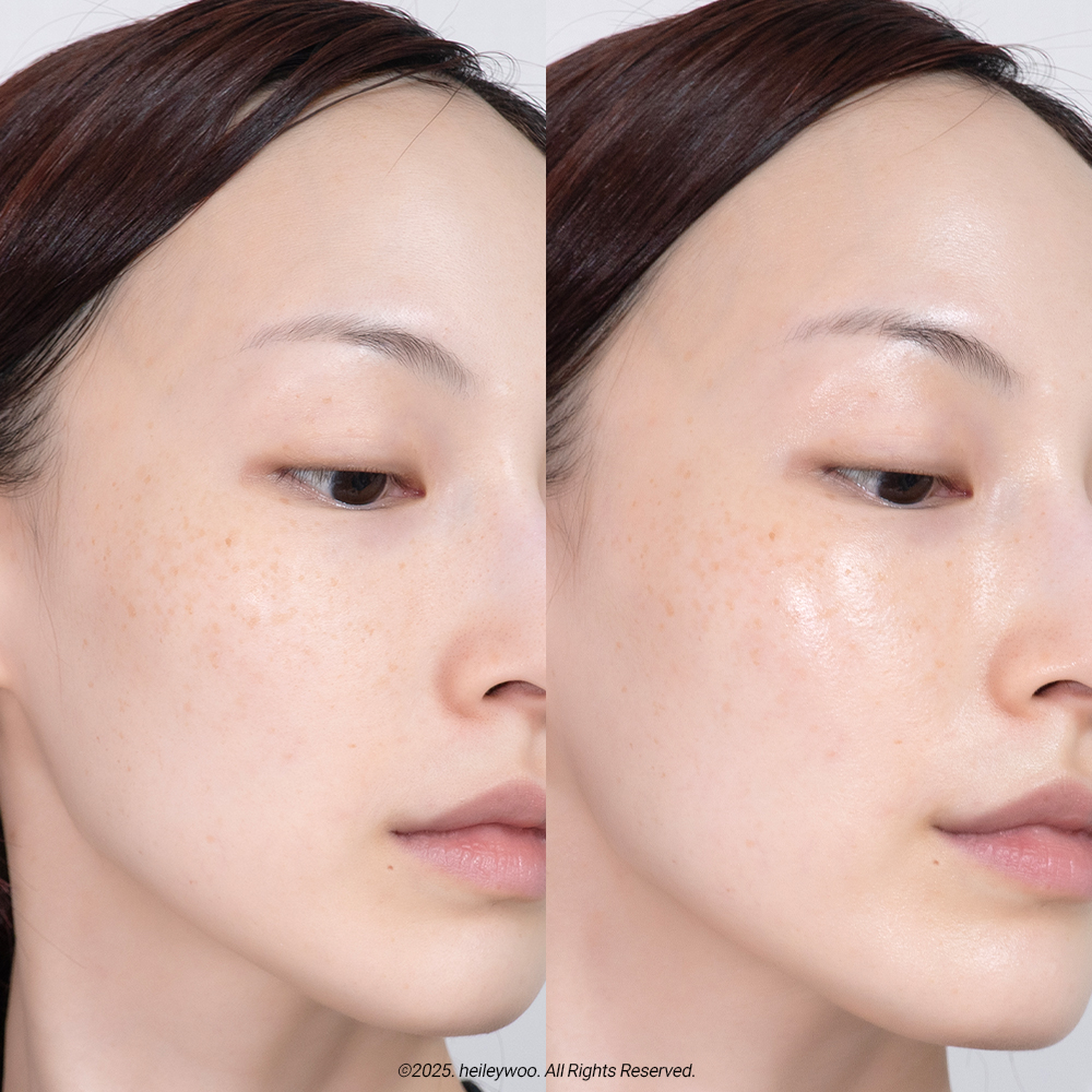 피드이미지정보-5