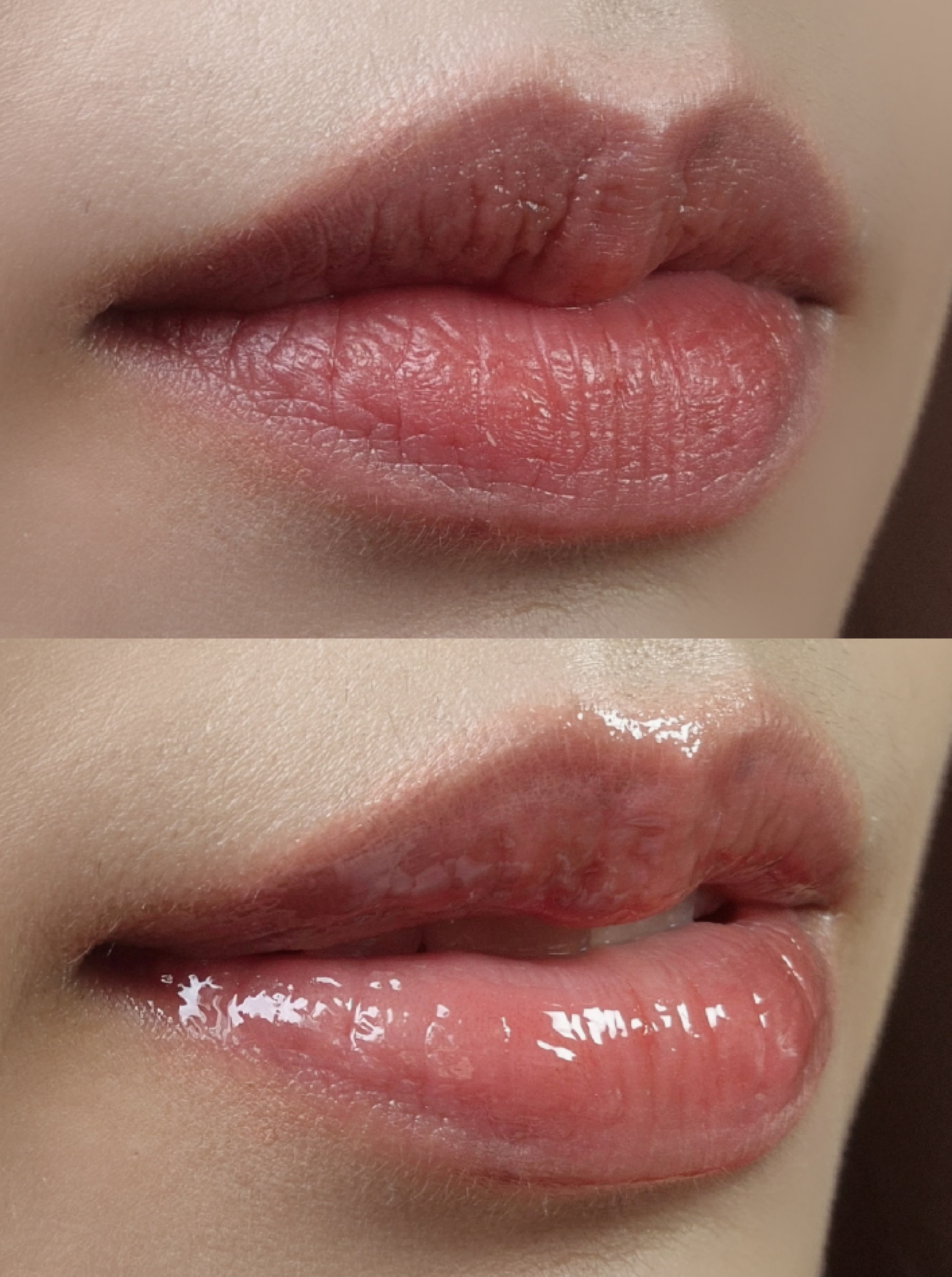 피드이미지정보-4