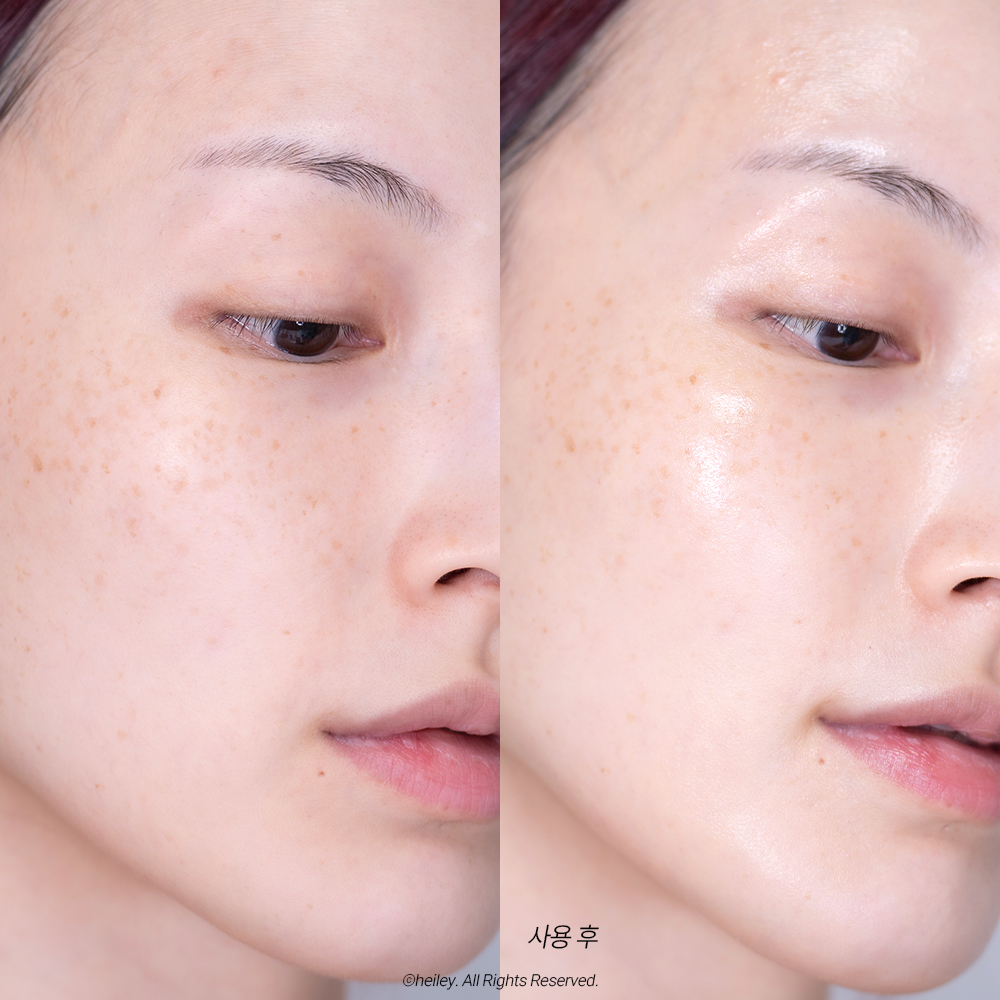 피드이미지정보-5