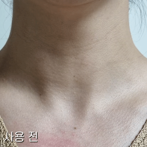 피드이미지정보-6