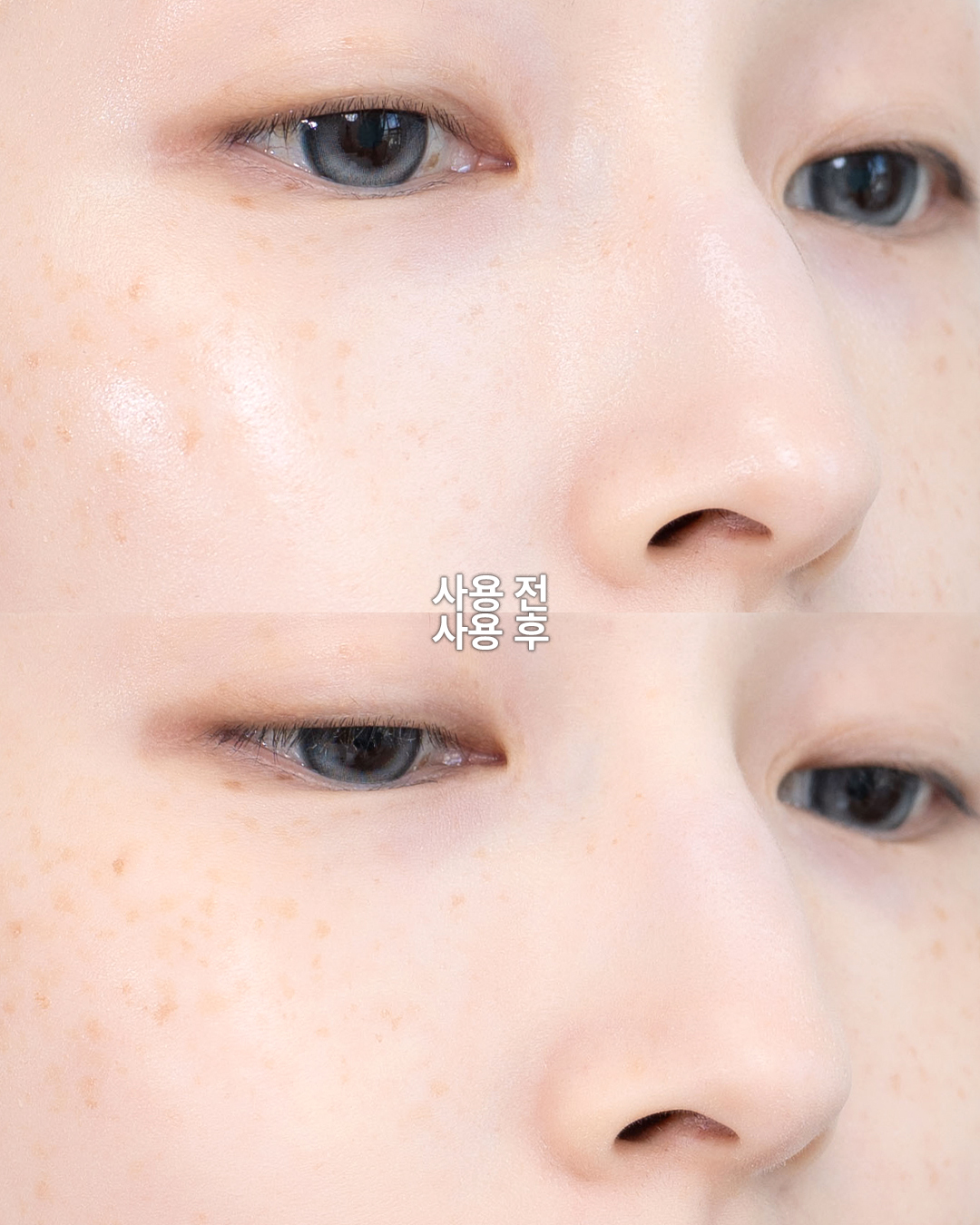 피드이미지정보-7