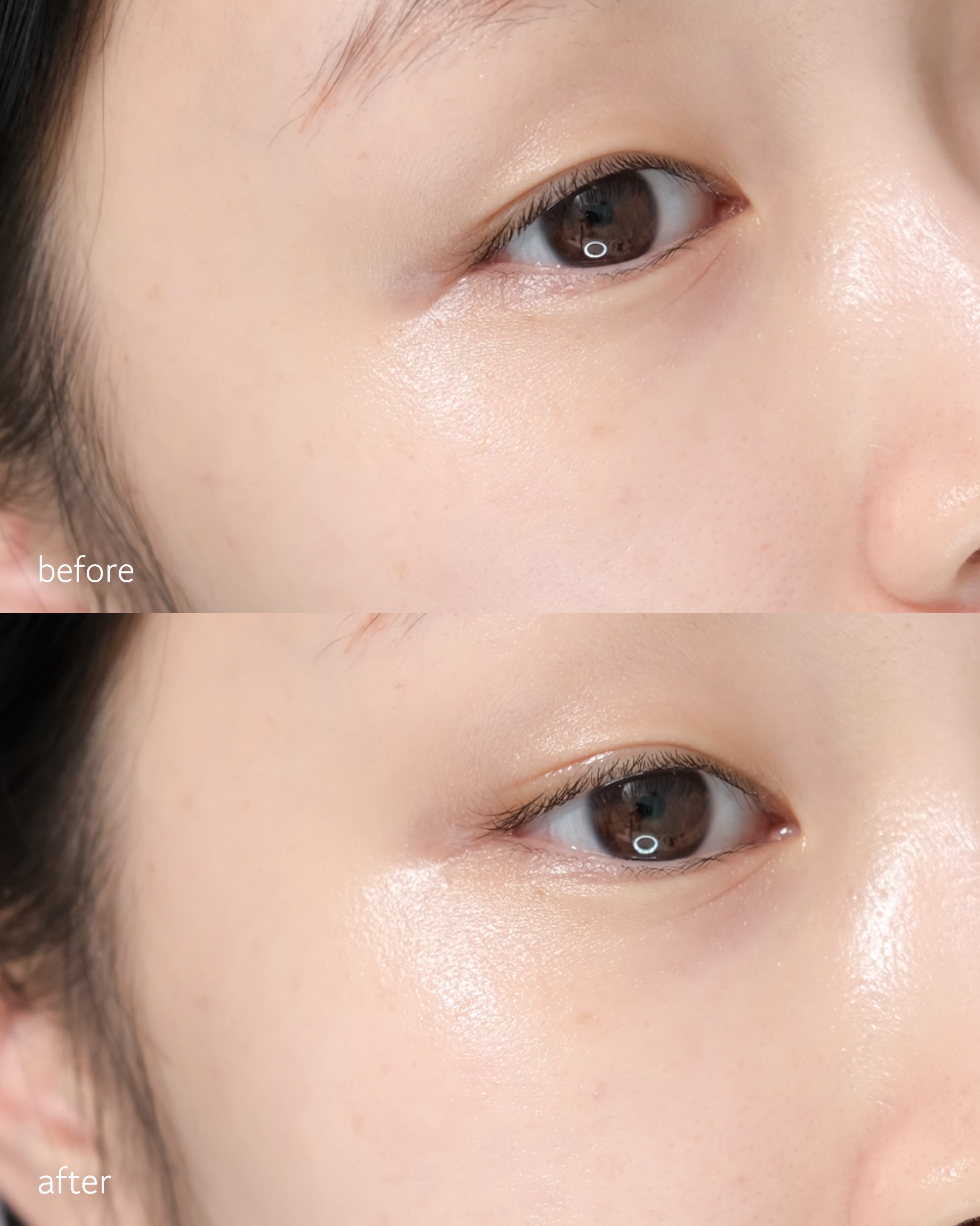 피드이미지정보-6