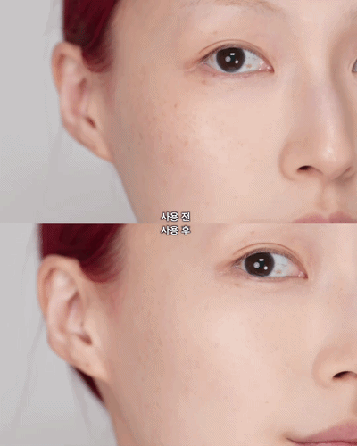 피드이미지정보-5