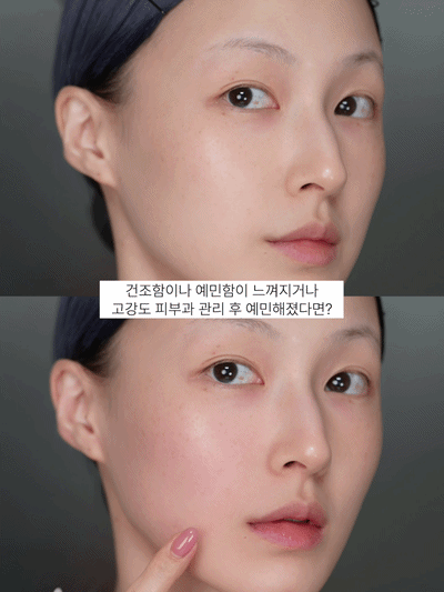 피드이미지정보-1
