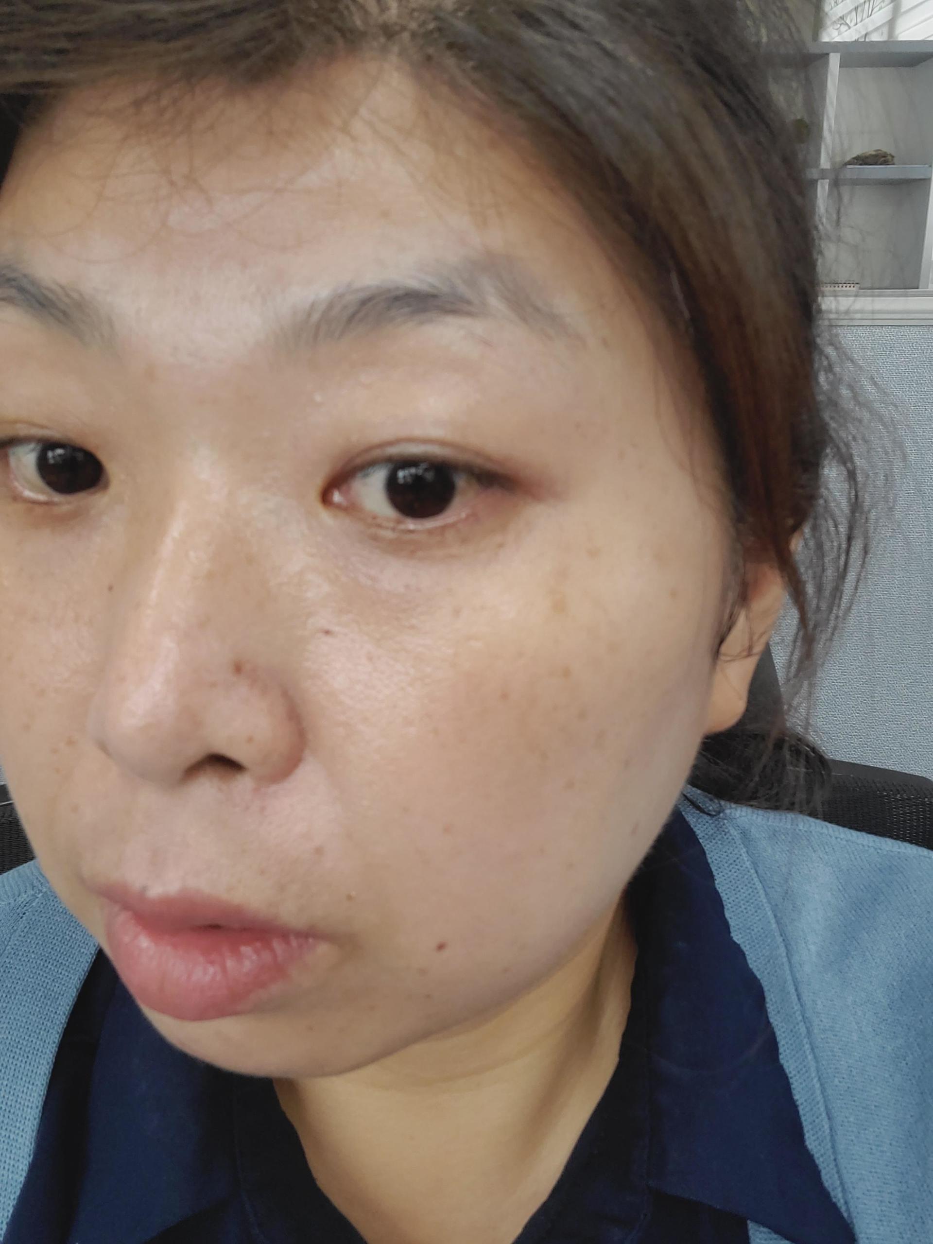 피드이미지정보-5