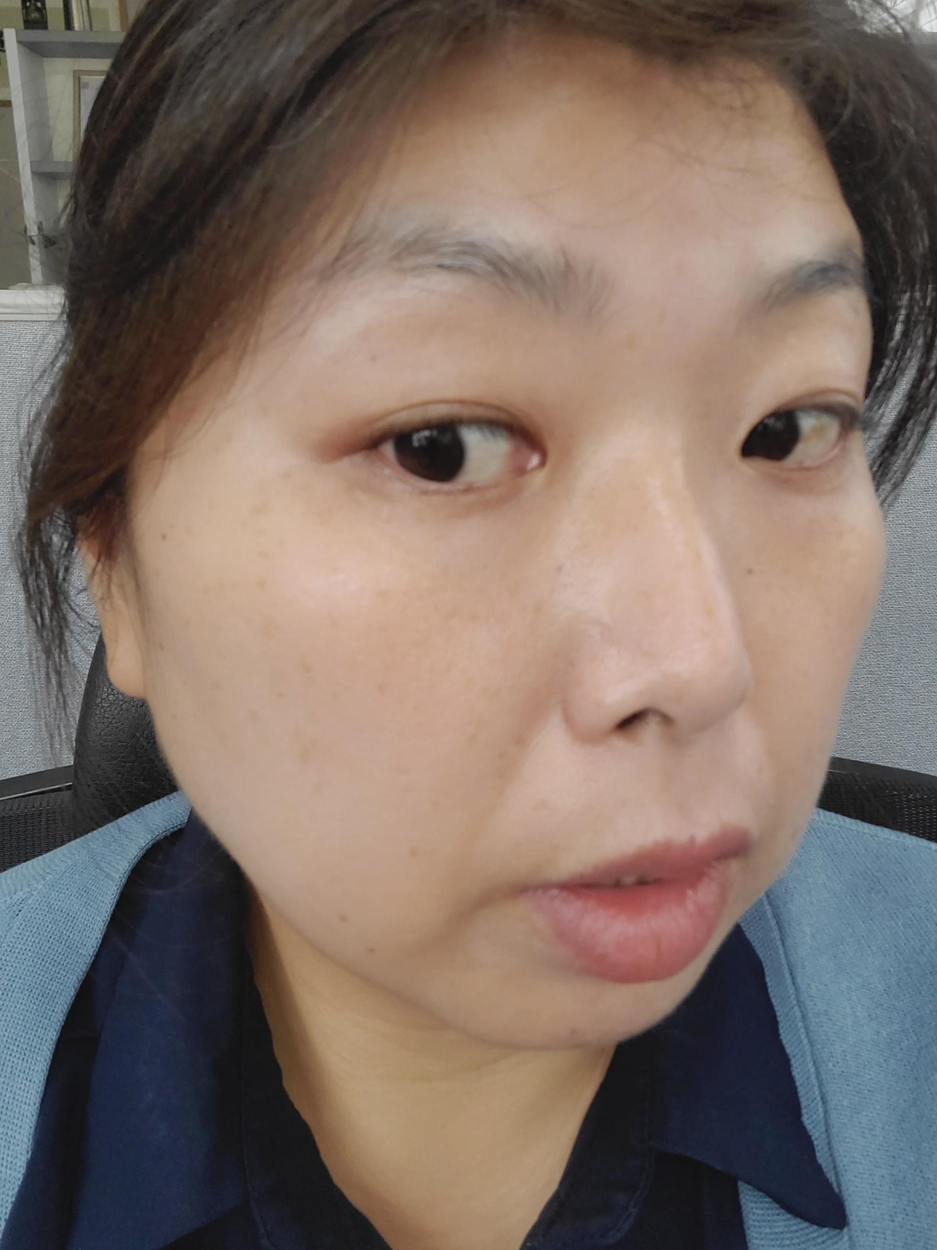 피드이미지정보-6